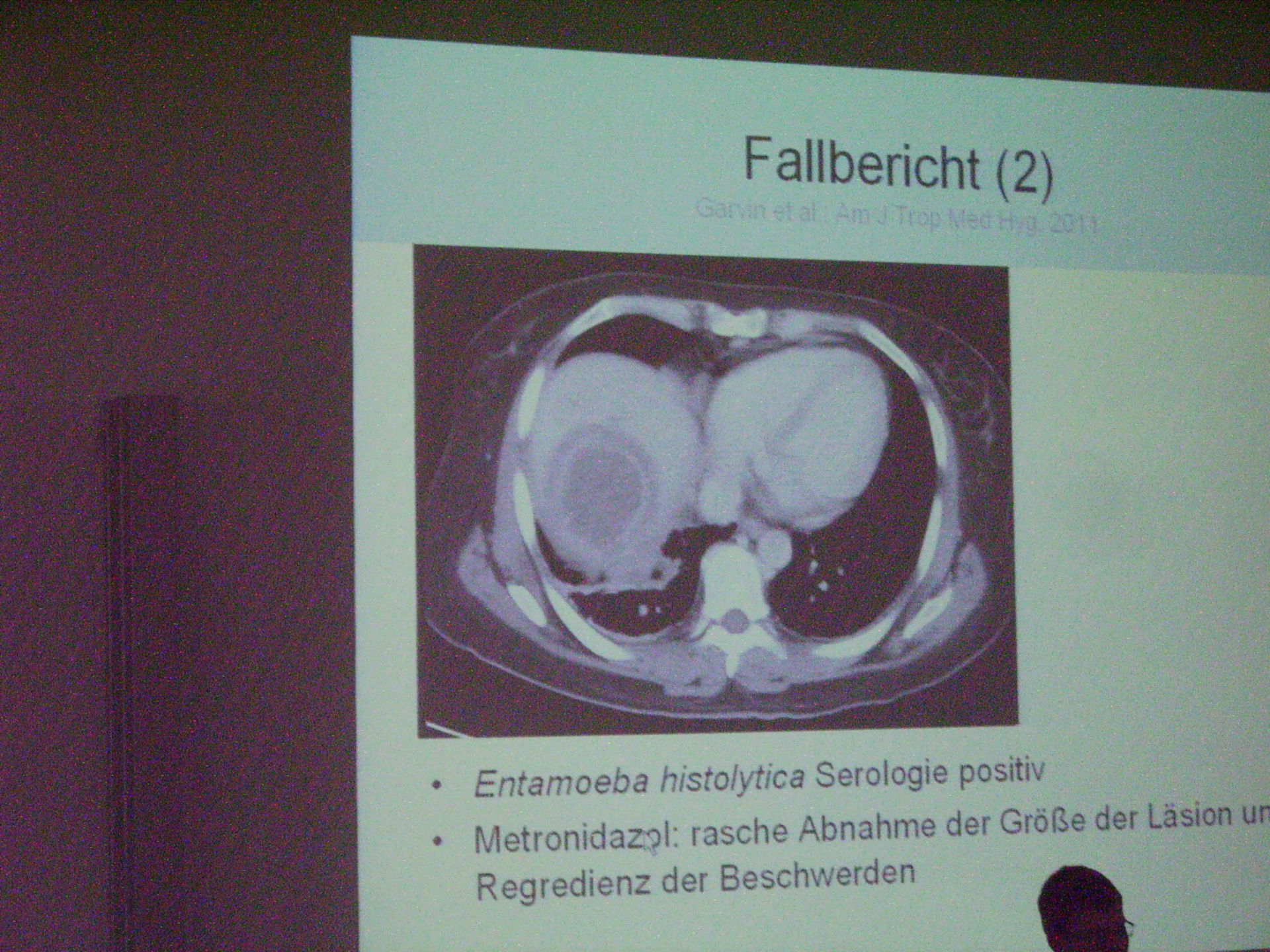 Corso di medicina tropicale a Lipsia