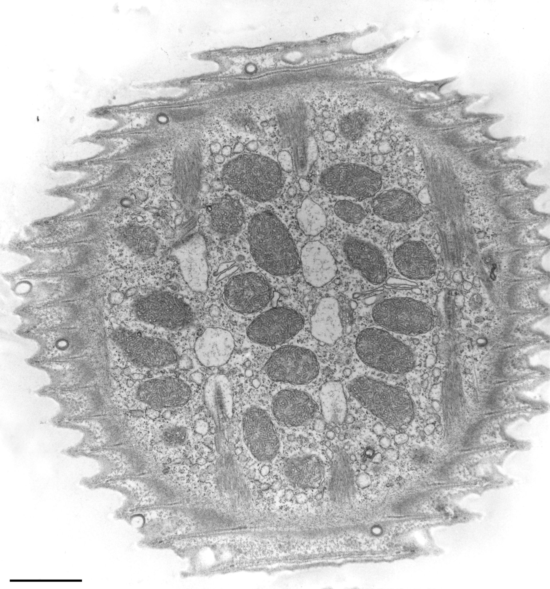 Vorticella convallaria (Cell cortex) - CIL:36270