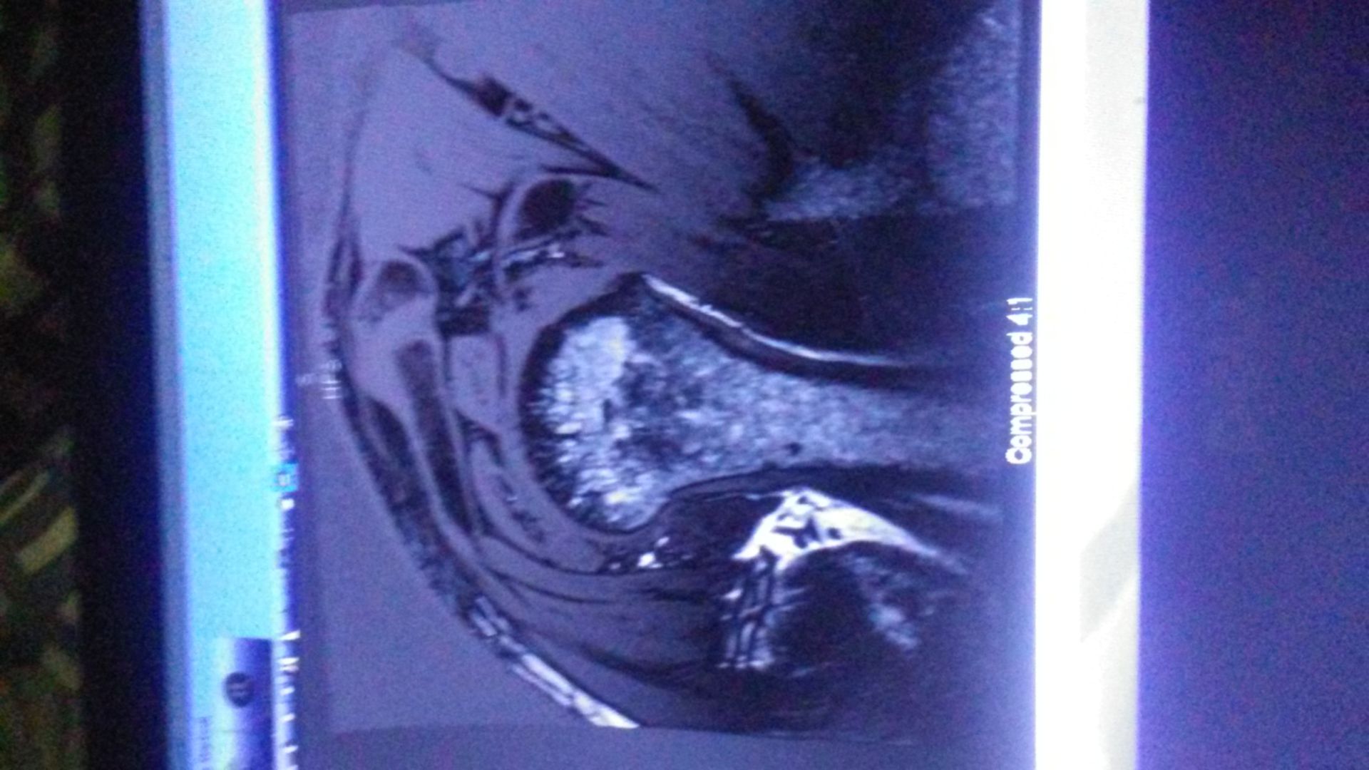 Röntgenbild Schultergelenk