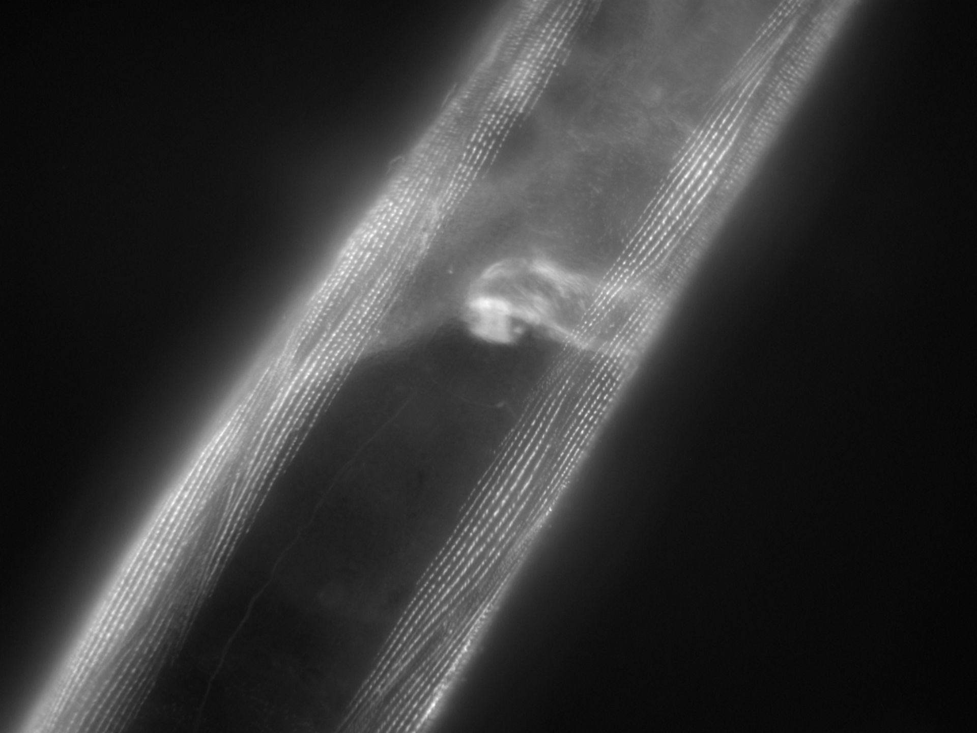 Caenorhabditis elegans (Actin filament) - CIL:1176