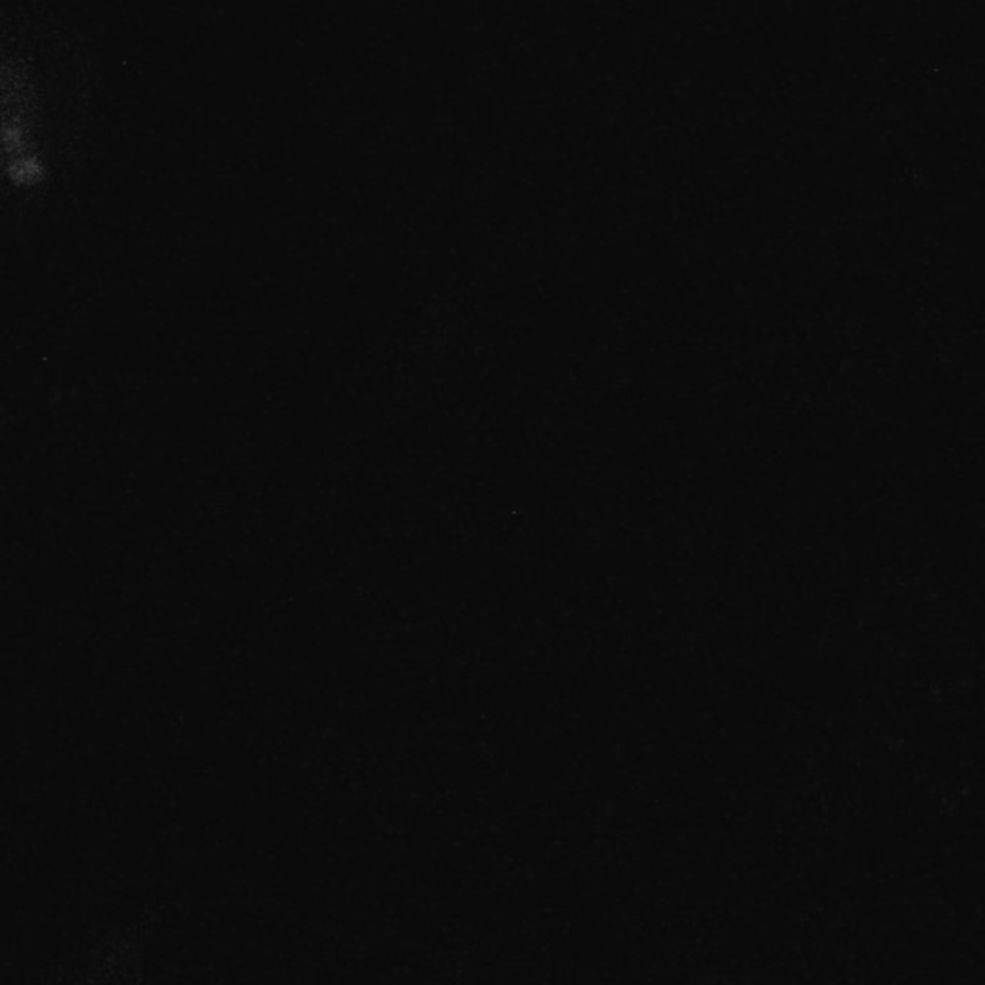 Xenopus laevis (Neuronal cell body) - CIL:36905