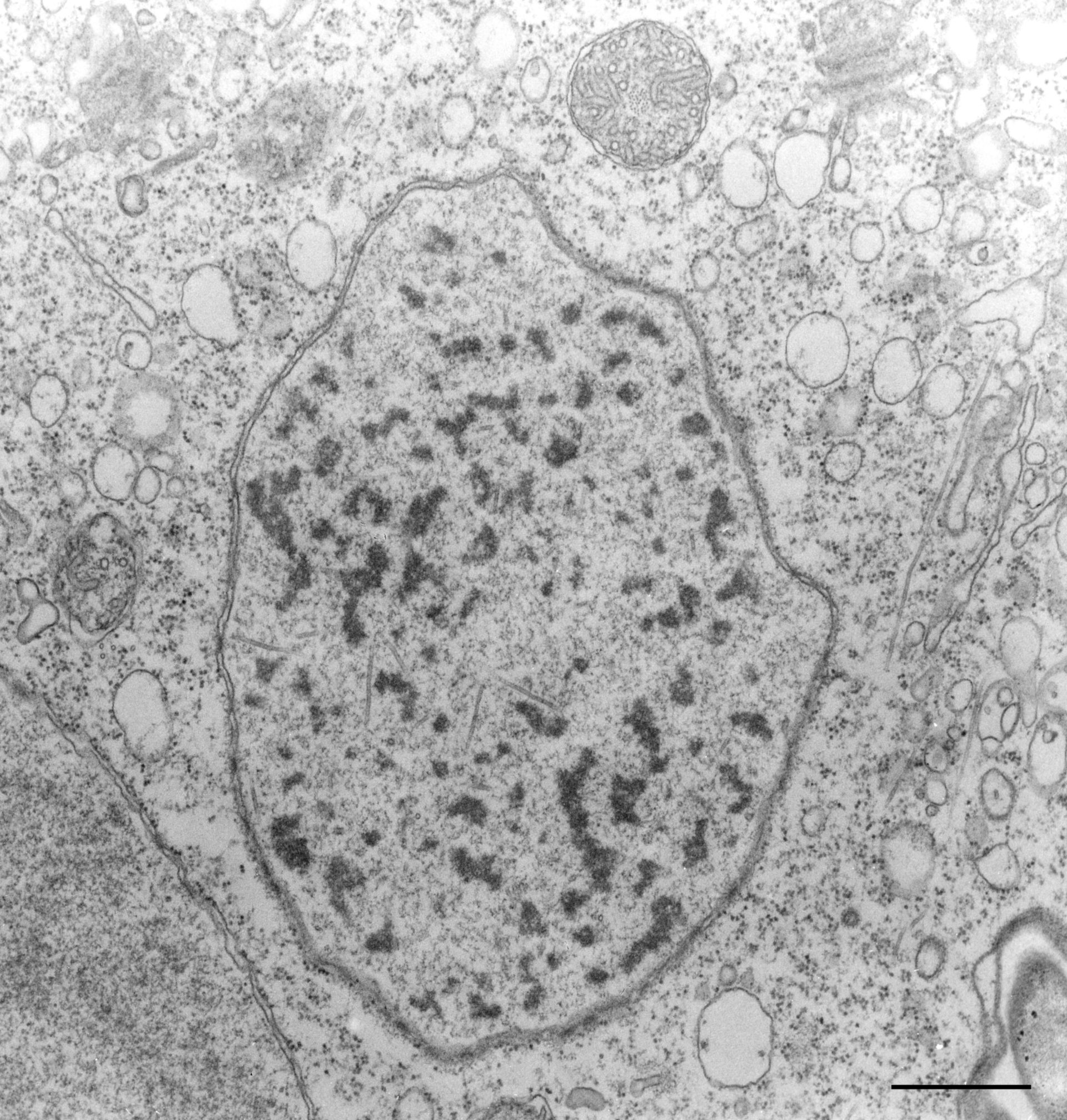 Vorticella convallaria (Heterochromatin) - CIL:36260