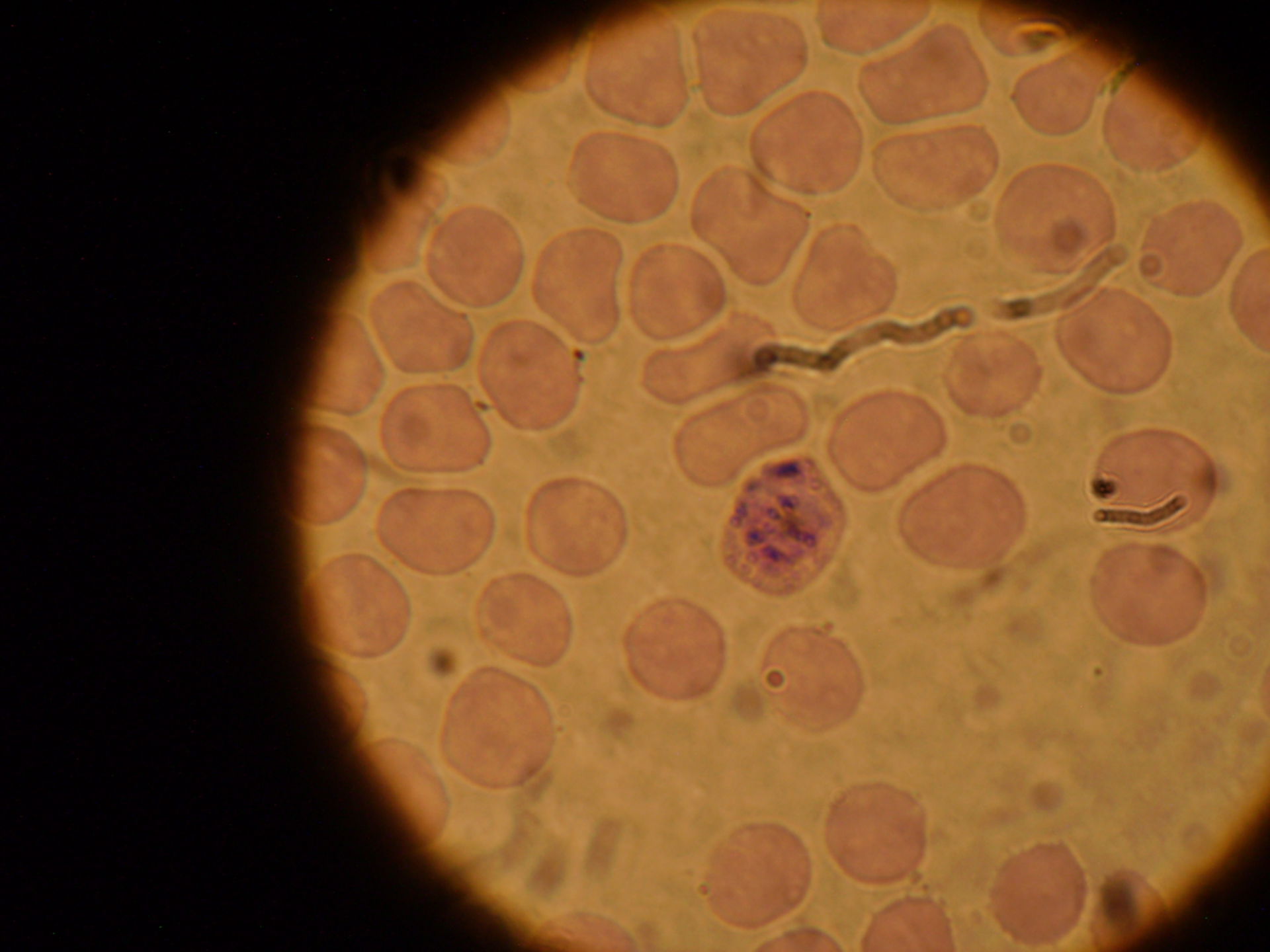 Plasmodium ovale Schizont c