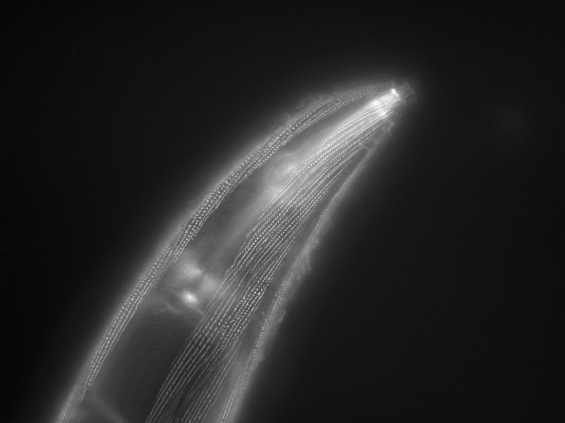 Caenorhabditis elegans (Actin filament) - CIL:1173