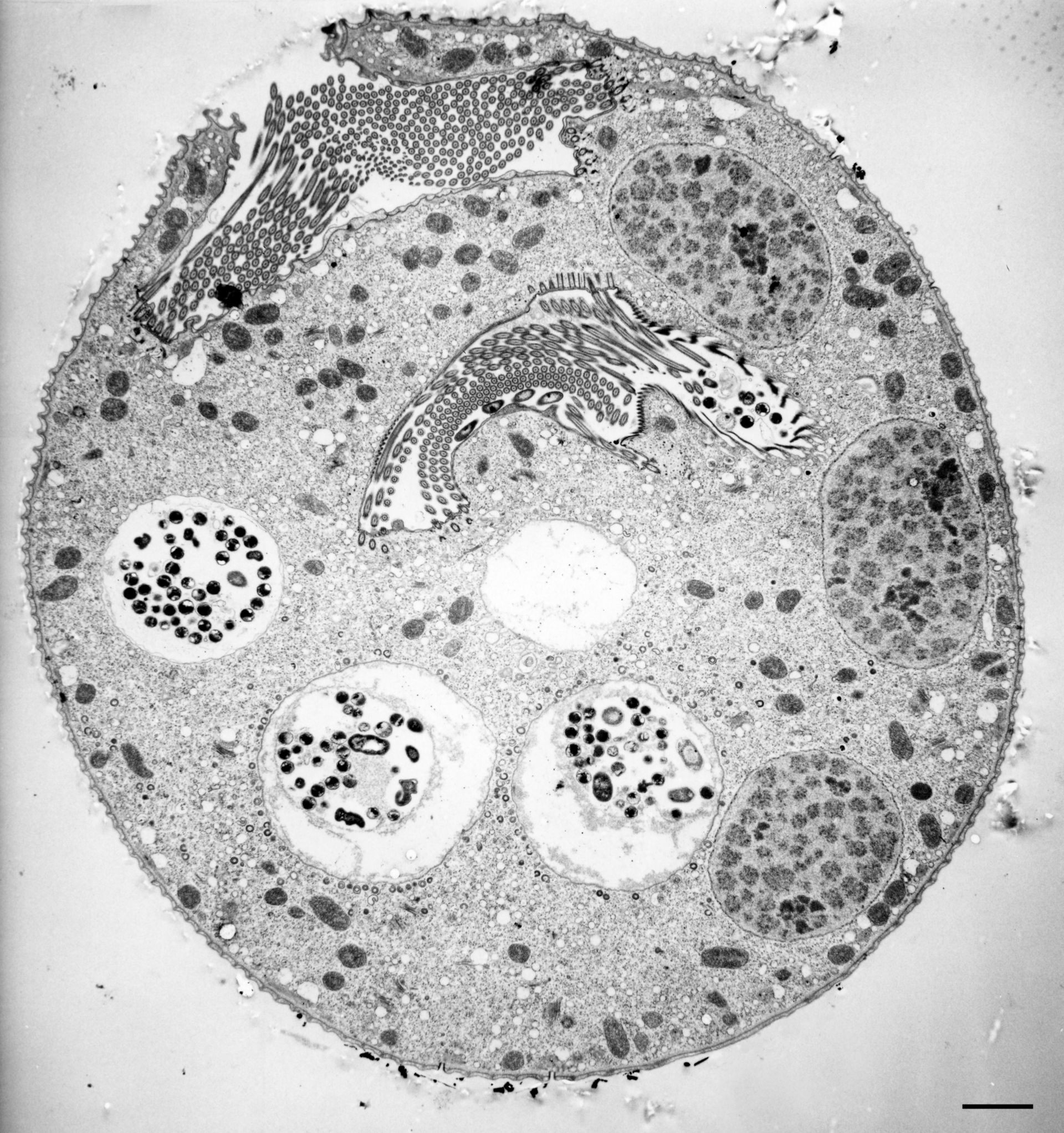 Vorticella convallaria (Cytostome) - CIL:36250