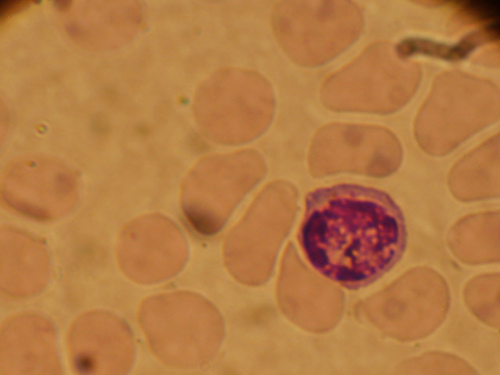 Plasmodium ovale schizonti