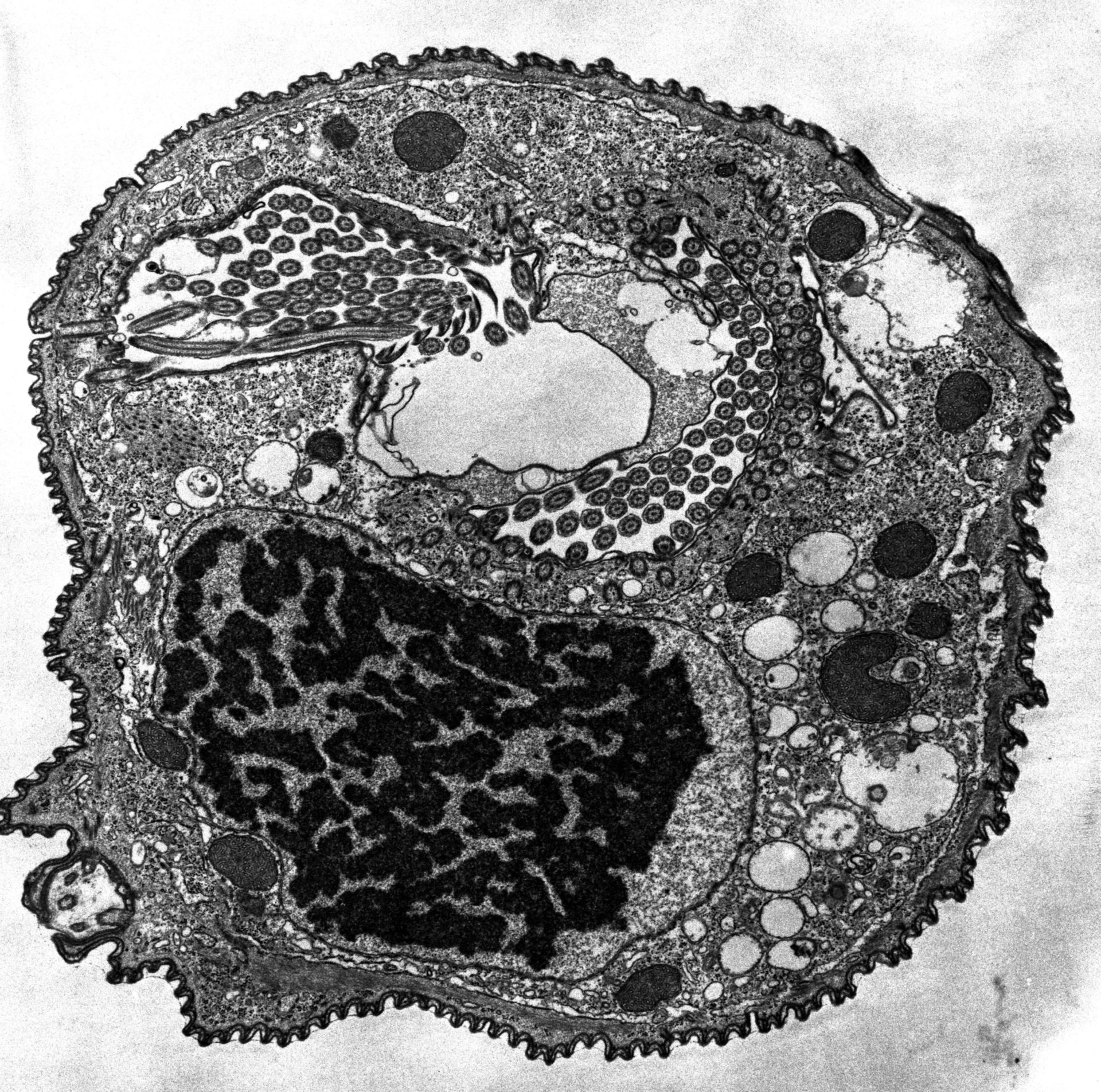 Opercularia coarctata (Cytoplasm) - CIL:39172