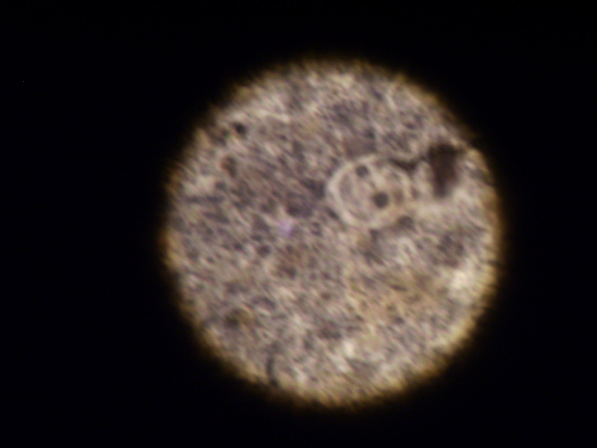 Lichtmikroskopische Aufnahme von Entaoeba coli