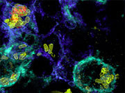 Von Salmonellen befallene Zellen (Makrophagen blau, Monozyten türkis), abgestorbene Salmonellen (nur gelb) und lebende Salmonellen (gelb und rot). © Universität Basel