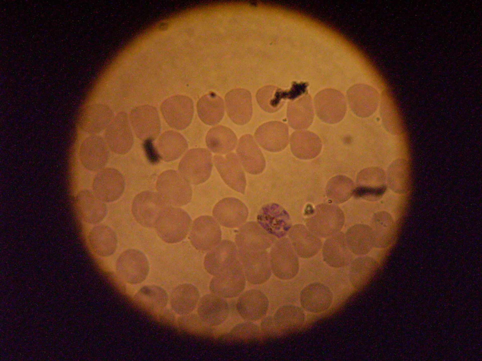 Plasmodium malariae rosettenform a.