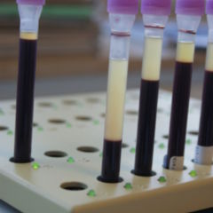 Erythrozytensedimentationsrate - DocCheck Flexikon