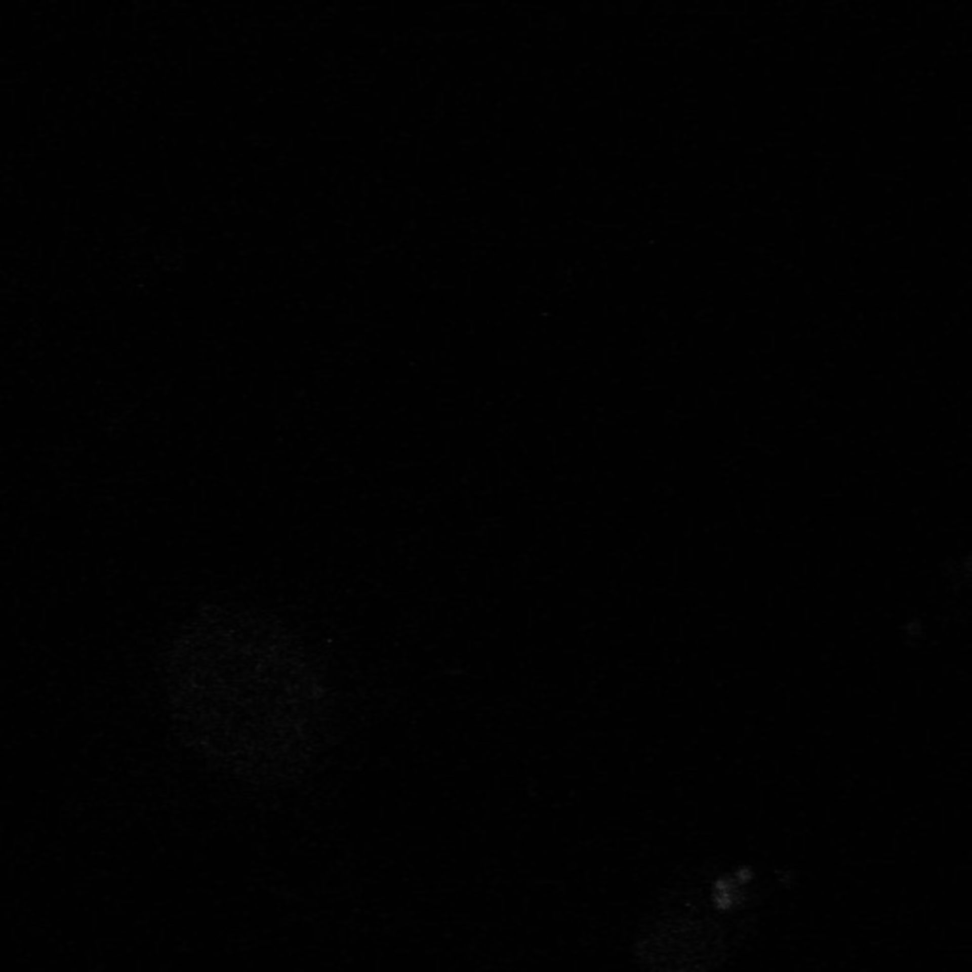 Xenopus laevis (Neuronal cell body) - CIL:37067