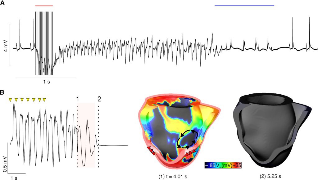 A: Optogenetische Defibrillation (blauer Balken) beendet Rhythmusstörung im Mäuseherz. B: Simulation der optogenetische Defibrillation (roter Balken) im Modell eines menschlichen Herzen. © Tobias Brügmann (Uni Bonn) / Patrick M. Boyle (Johns Hopkins University)