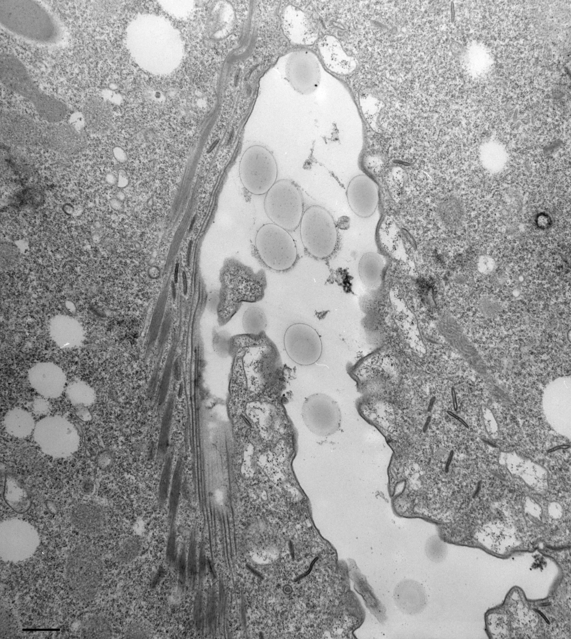 Paramecium multimicronucleatum (Microtubule associated complex) - CIL:36699