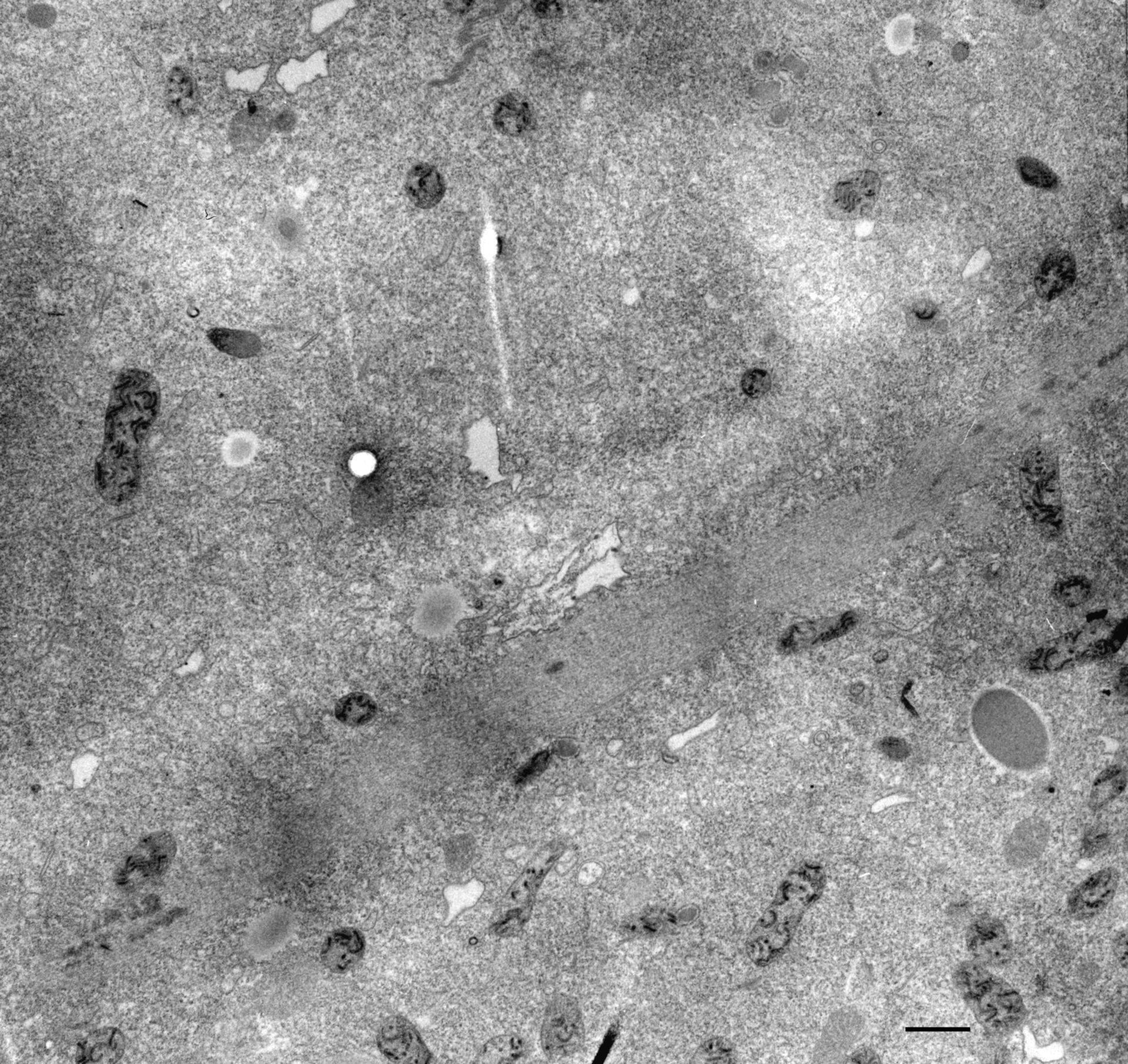 Paramecium multimicronucleatum (Micronucleus) - CIL:36650