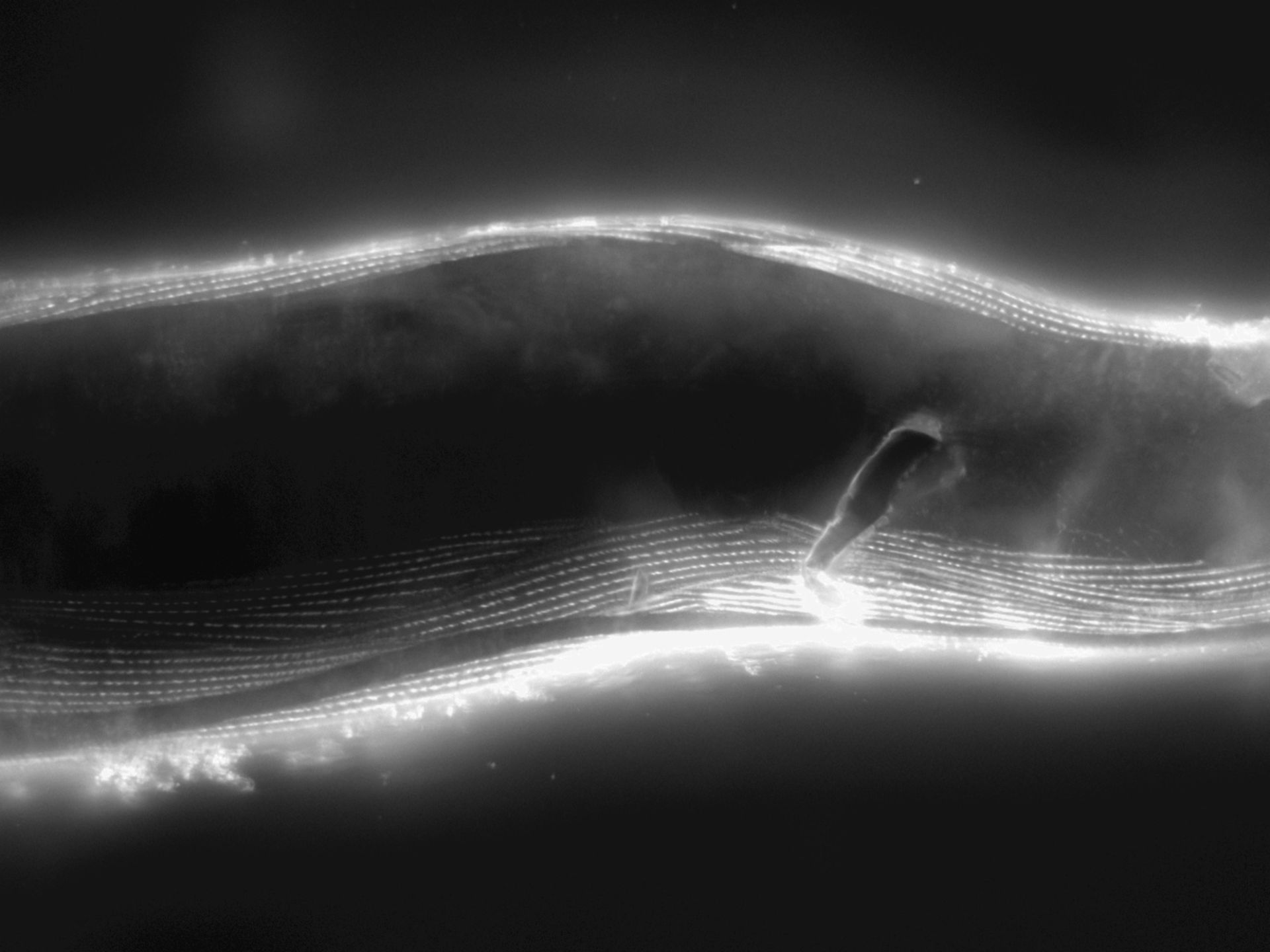 Caenorhabditis elegans (Actin filament) - CIL:1198