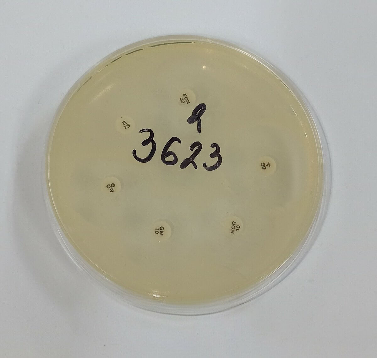 Müller-Hinton-Agar