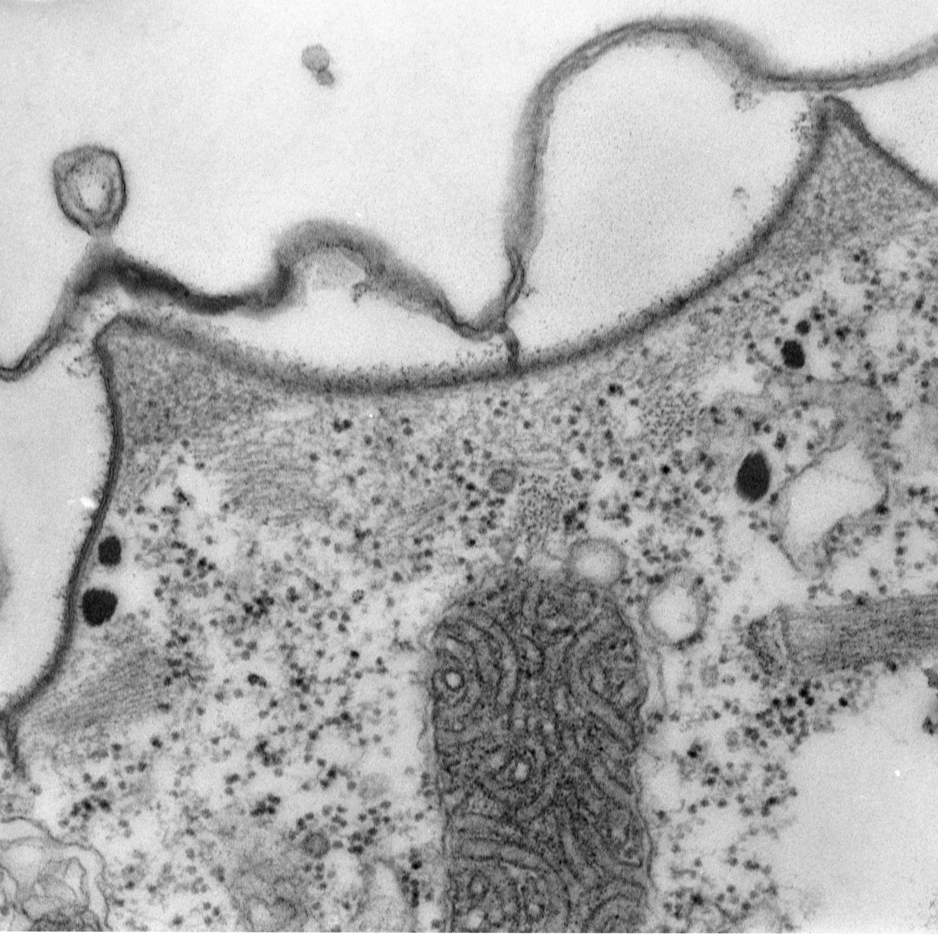 Paramecium multimicronucleatum (Cell cortex) - CIL:39311