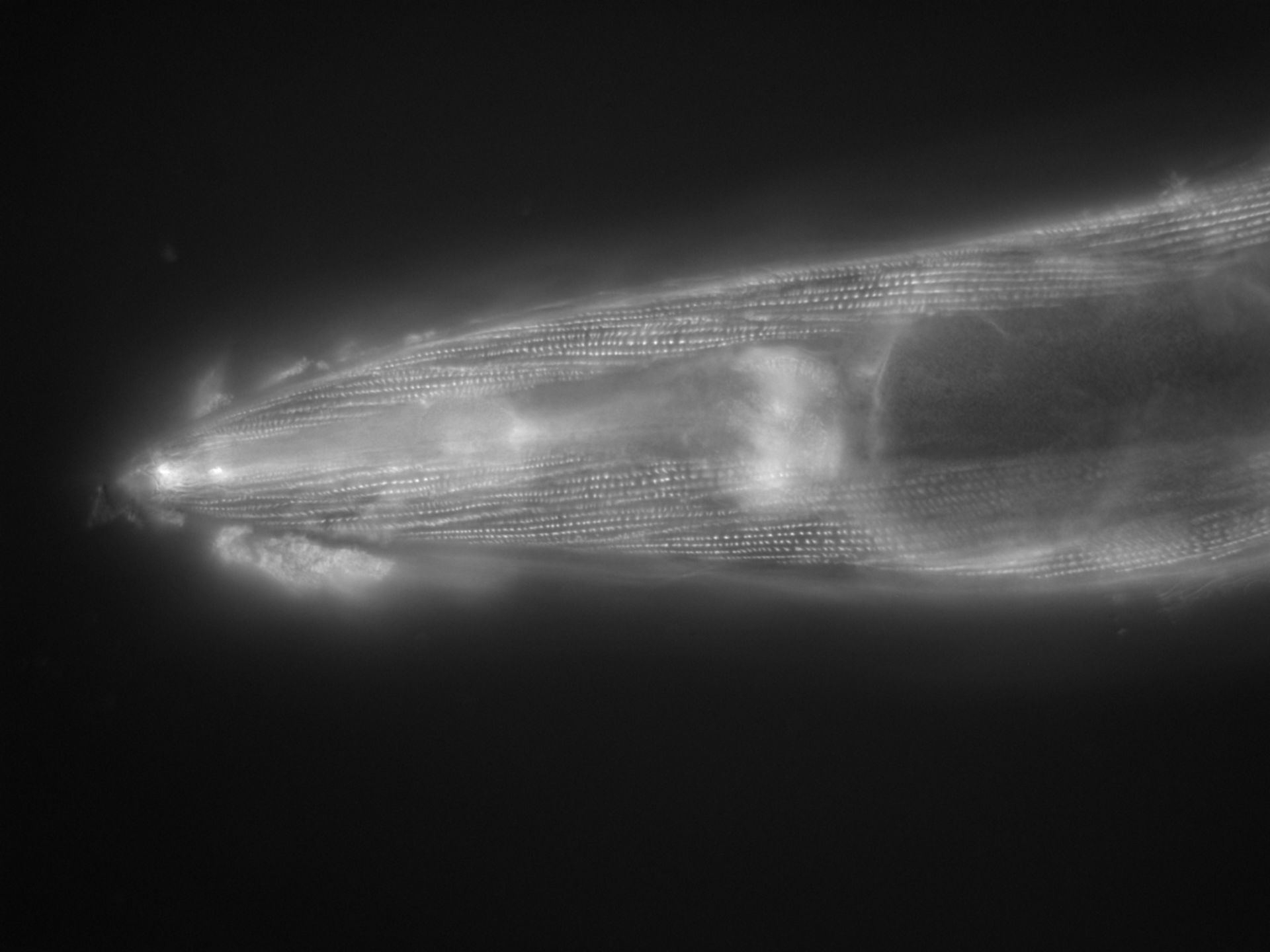 Caenorhabditis elegans (Actin filament) - CIL:1184