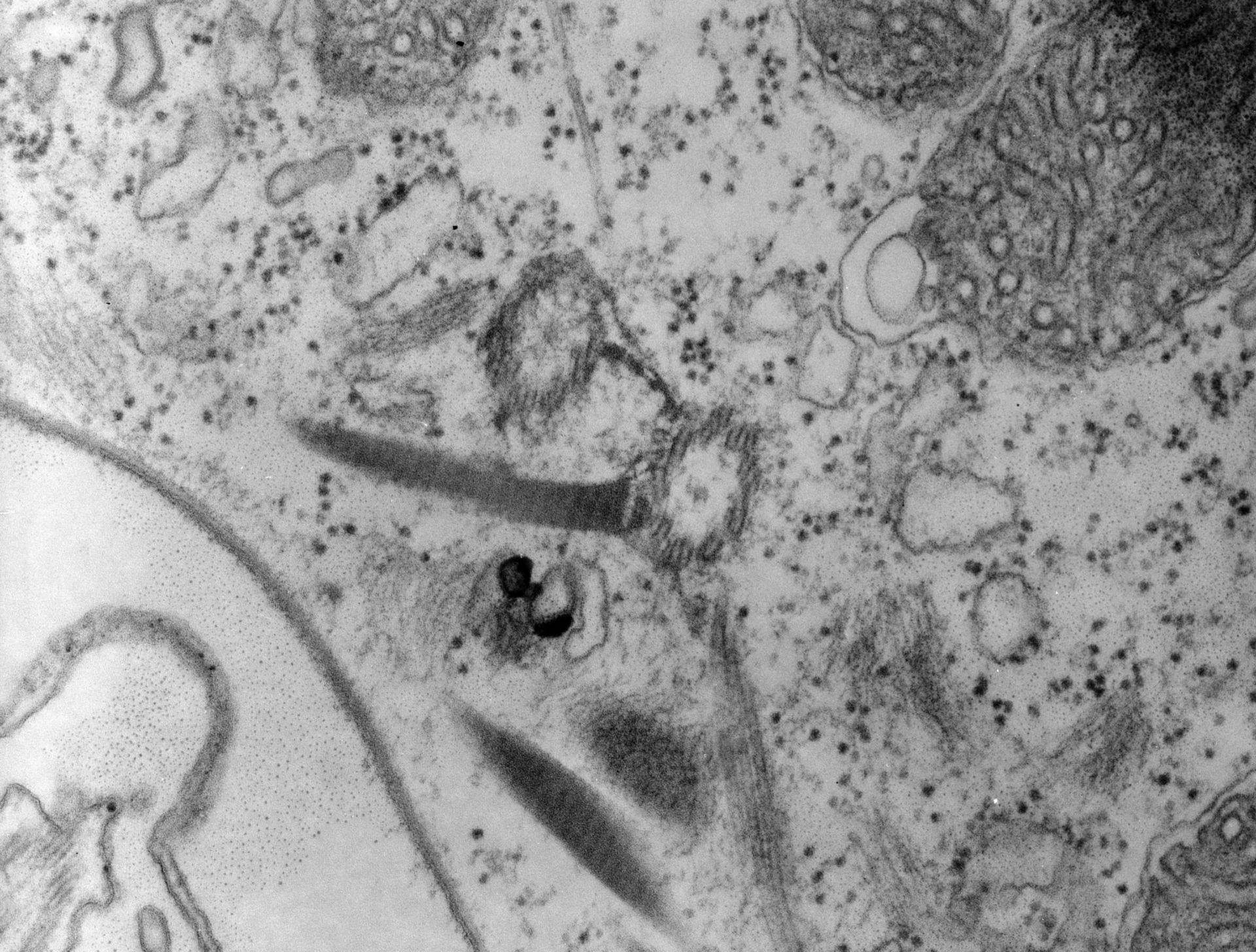 Paramecium multimicronucleatum (Microtubule basal body) - CIL:12067
