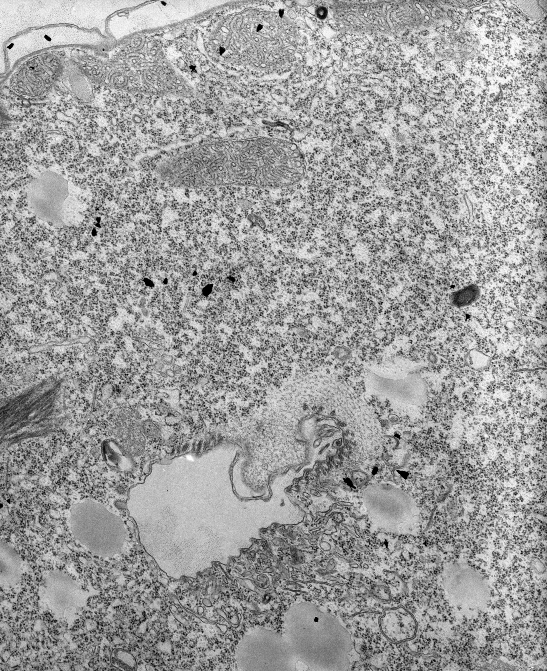 Tetrahymena pyriformis (Vesicle membrane) - CIL:39719