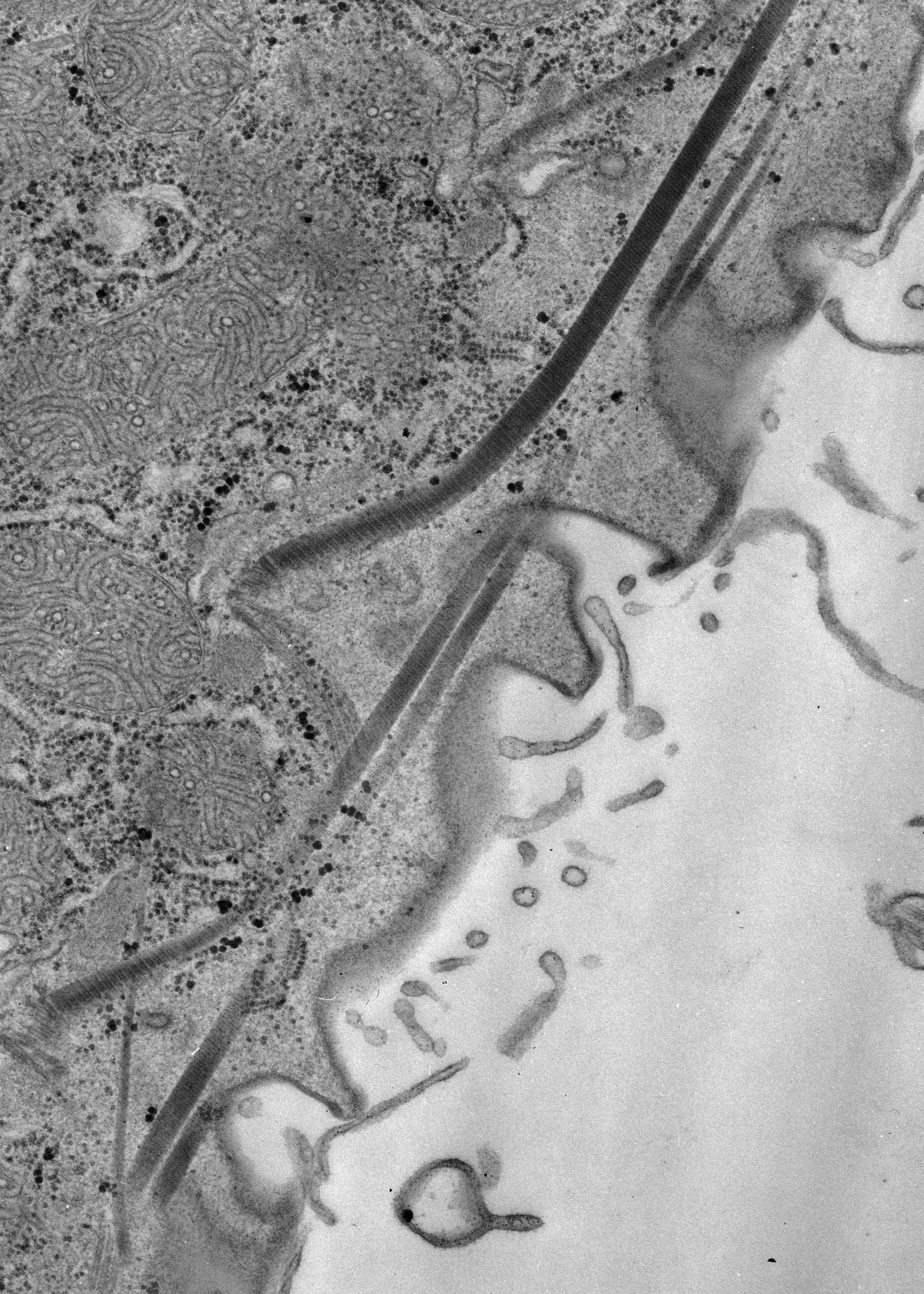Paramecium caudatum (Kinetodesmal fiber) - CIL:38900
