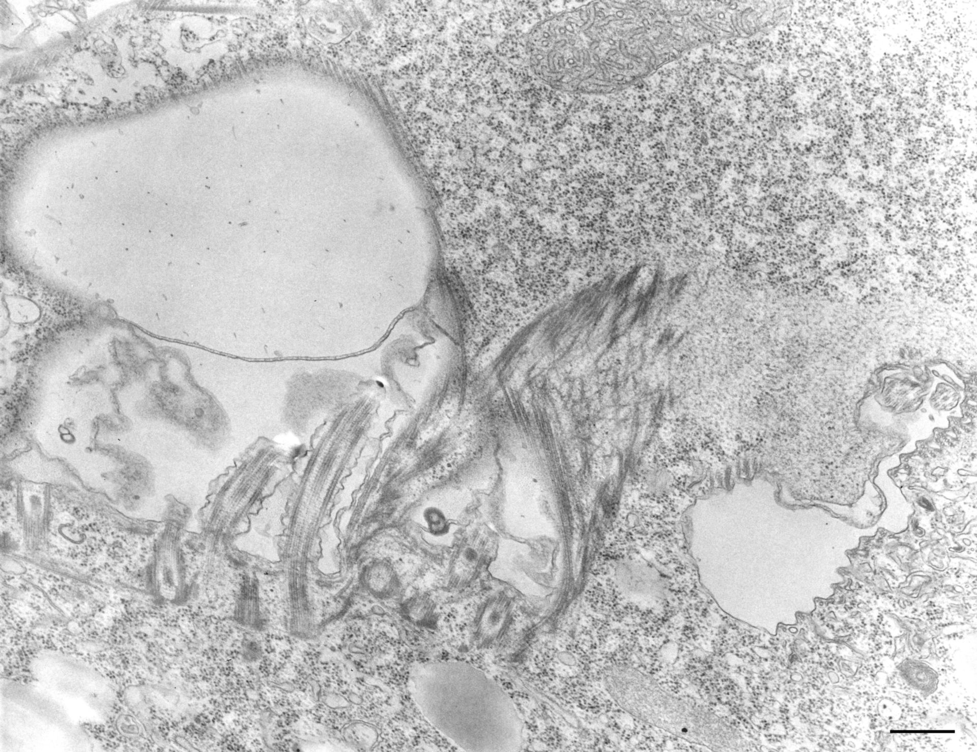 Tetrahymena pyriformis (Oral apparatus) - CIL:36220