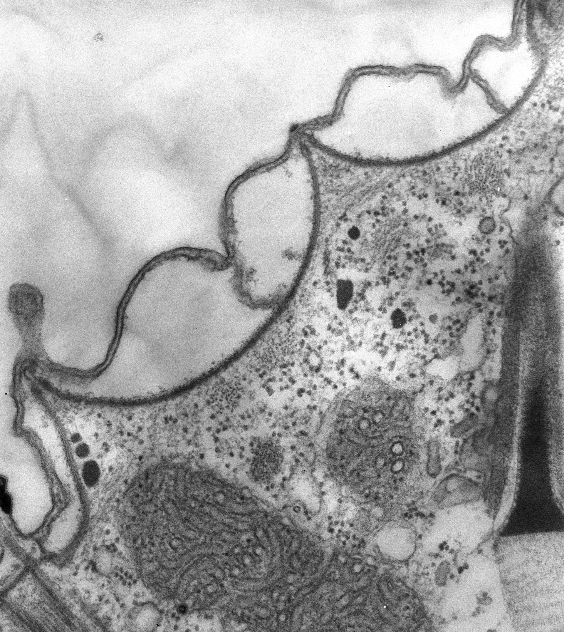 Paramecium multimicronucleatum (Cell cortex) - CIL:39310