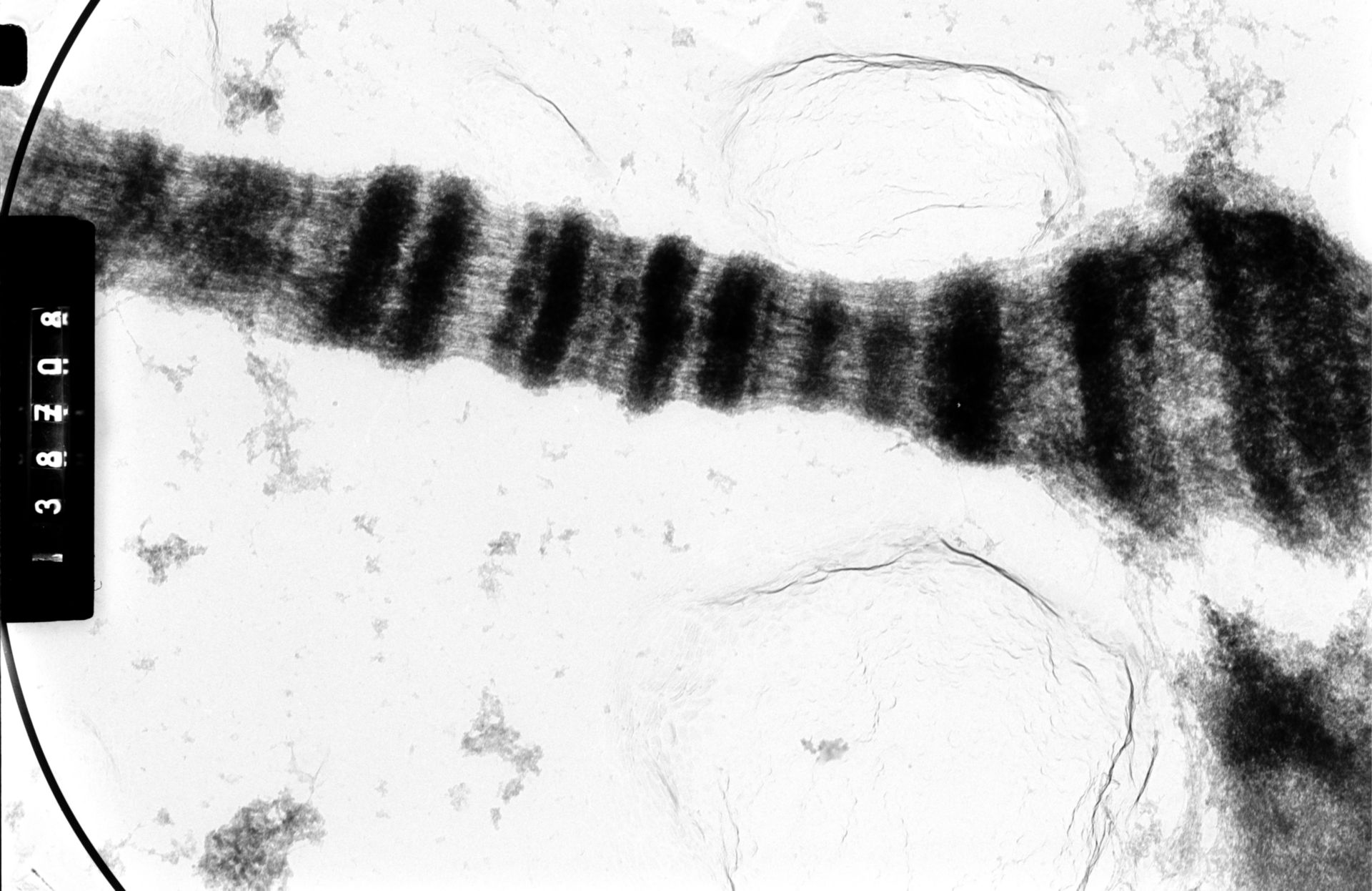 Drosophila melanocephala (Polytene chromosome) - CIL:35403