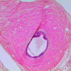 Ductus Cysticus Doccheck Flexikon