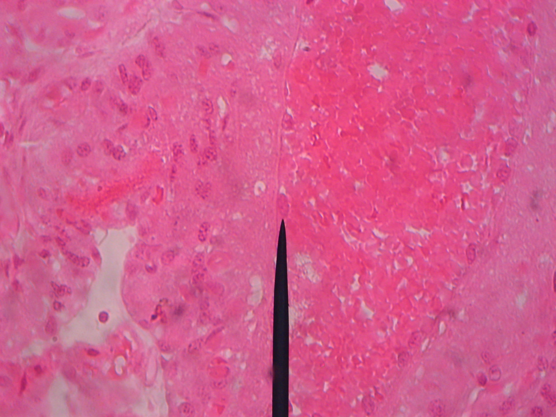 Plazenta des Hundes (3)-  Endothelzellkern maternale Kapillare