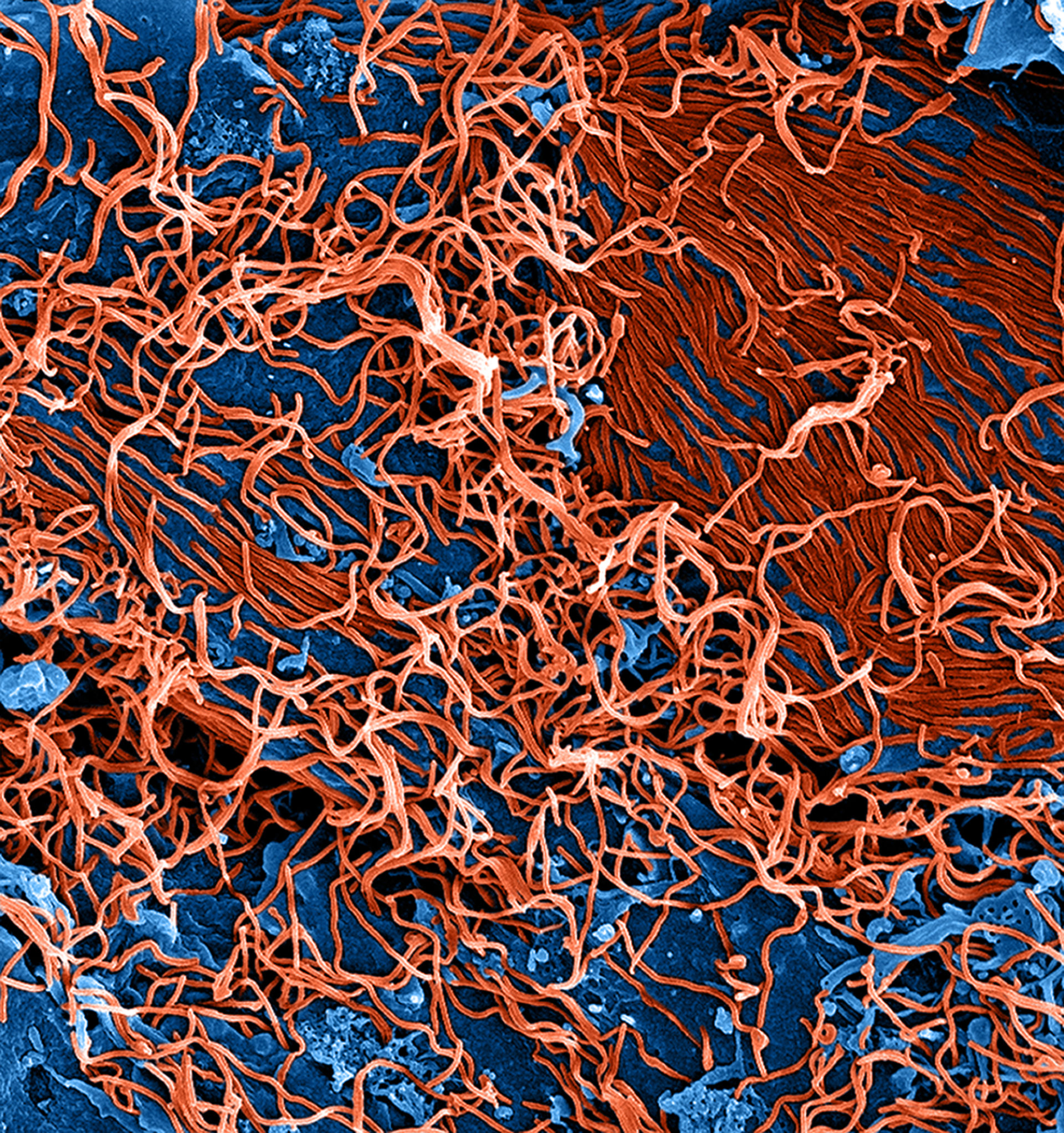 Partícula del virus de ebola