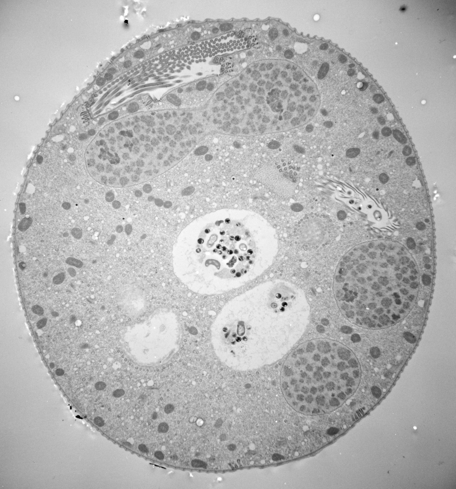 Vorticella convallaria (Food vacuole) - CIL:39404