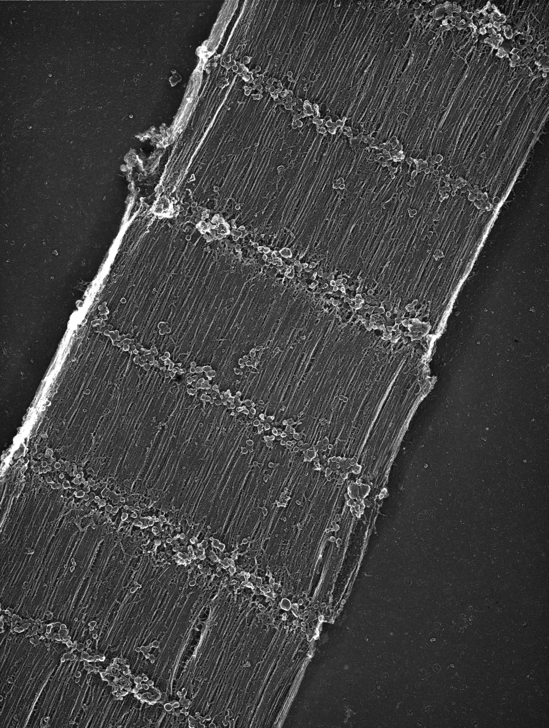 Damselfly (Sarcoplasmic reticulum) - CIL:22687