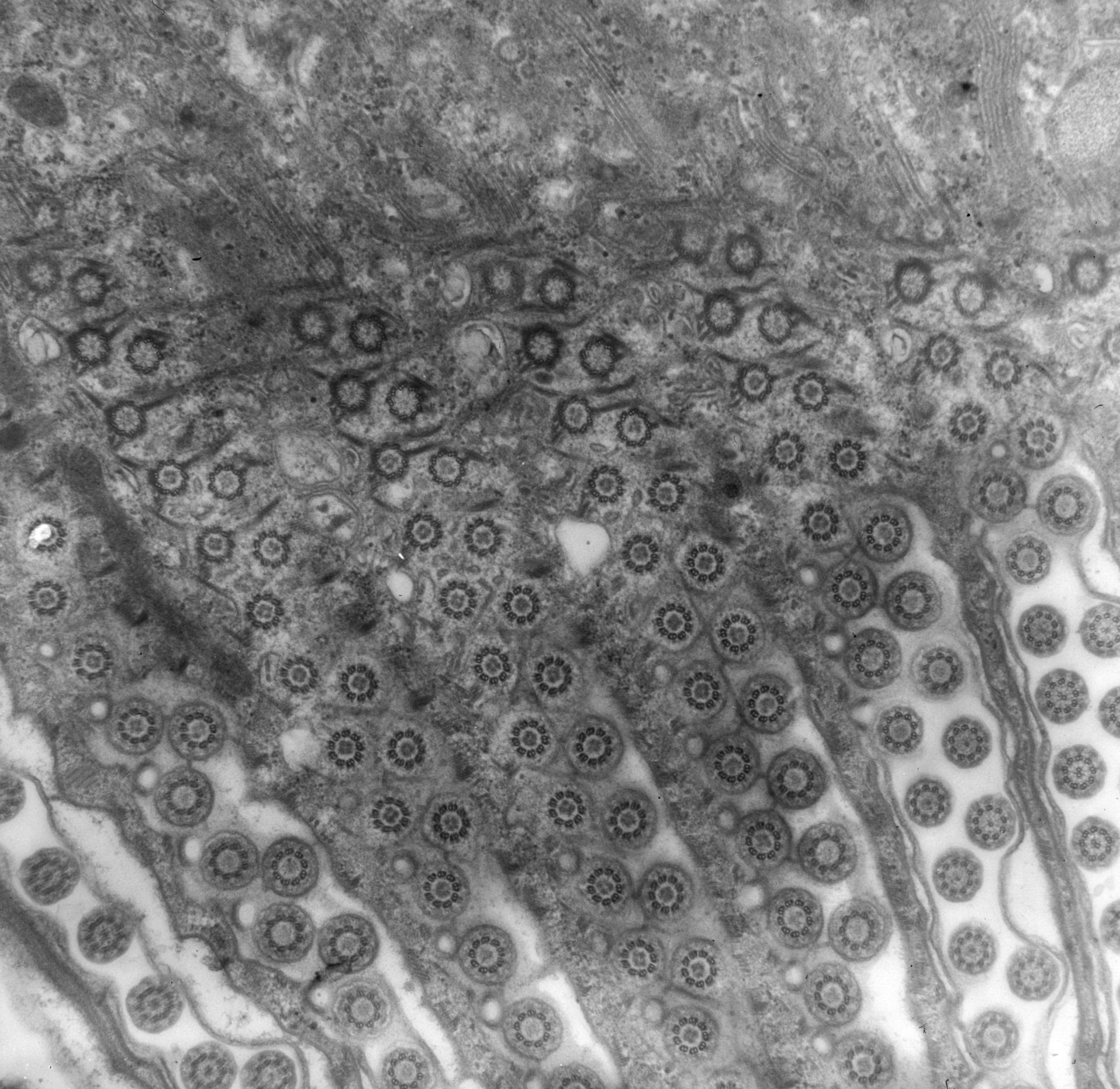 Conchophthirus curtus (Oral apparatus) - CIL:39237