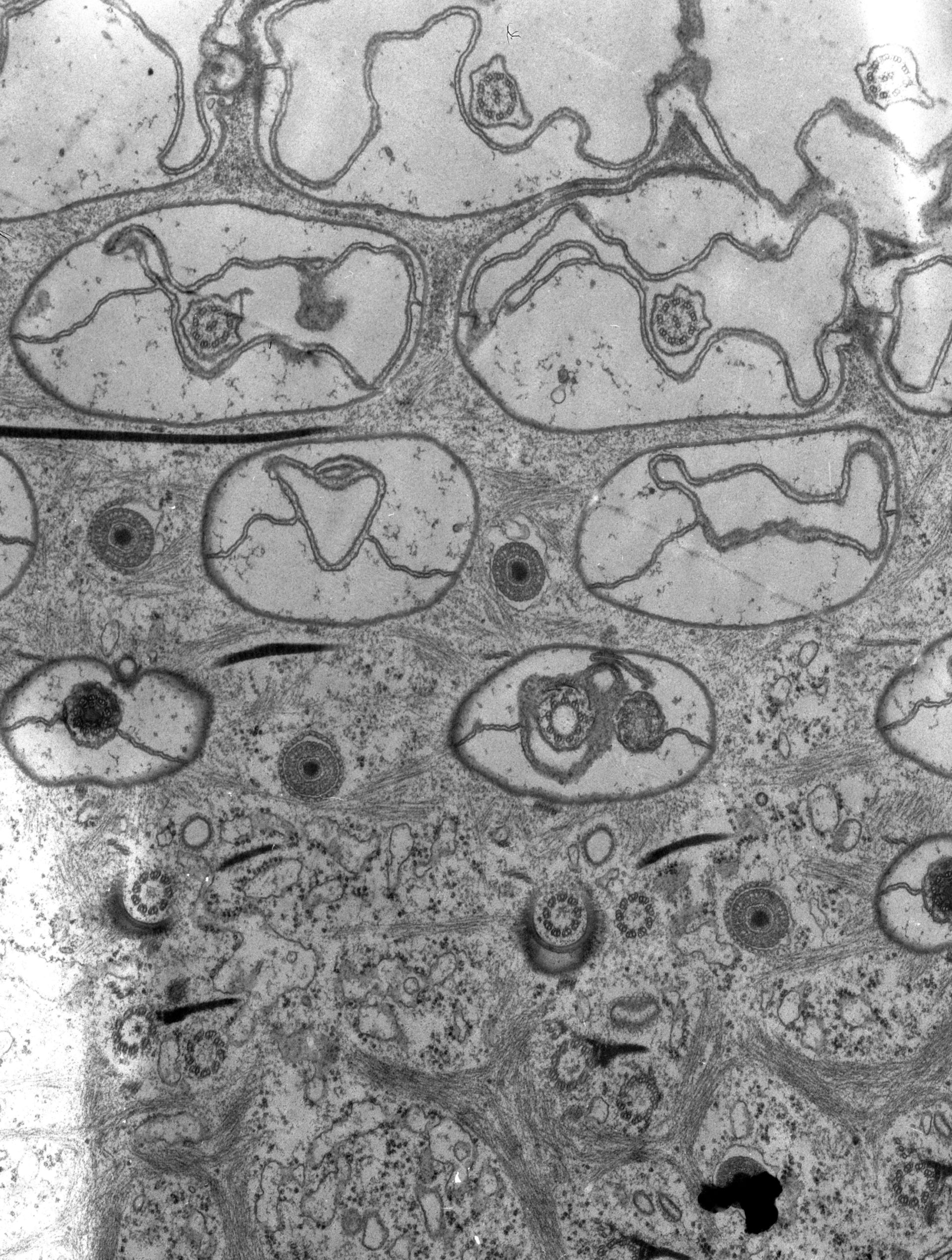 Paramecium caudatum (Microtubule basal body) - CIL:38892