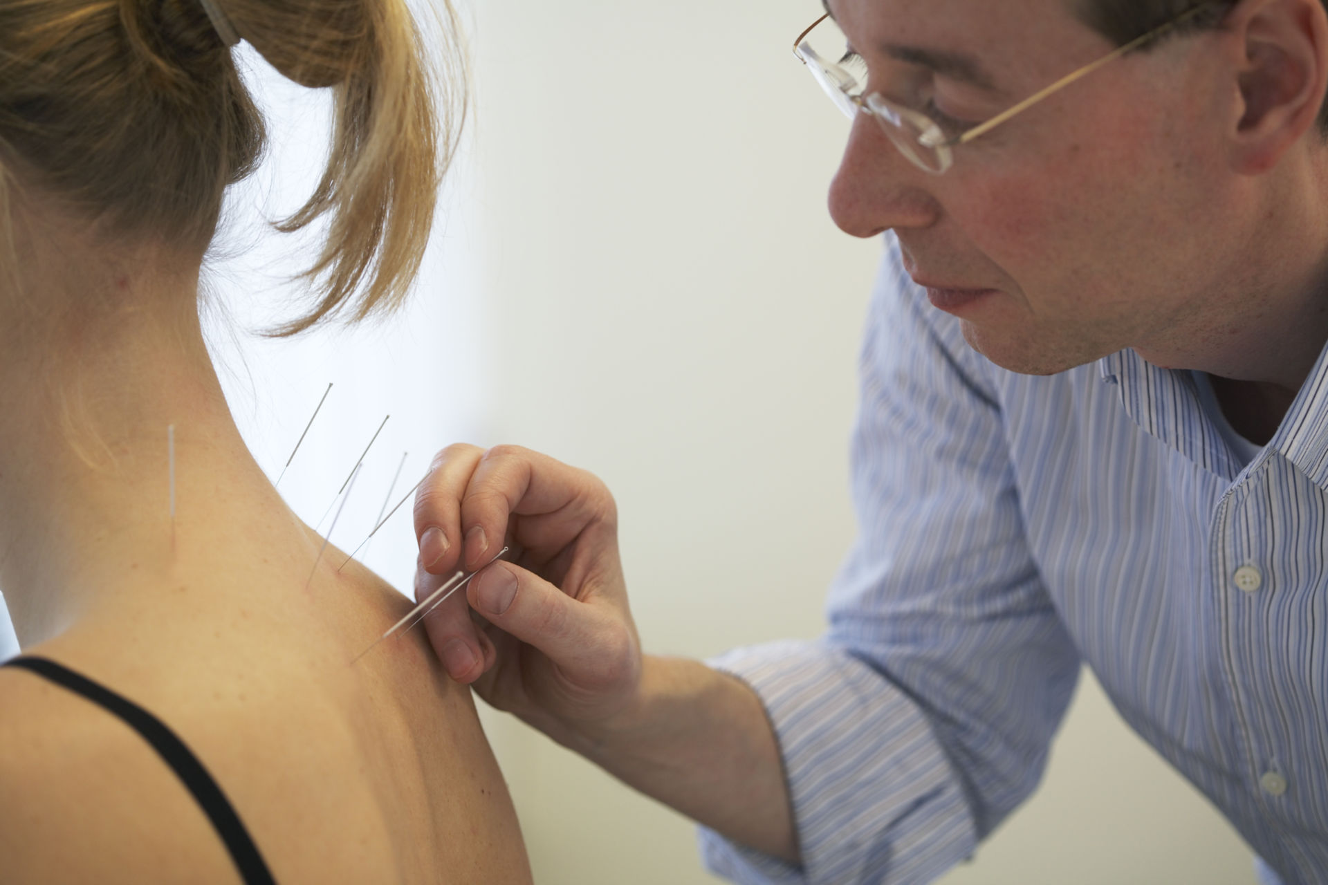 Acupuncture