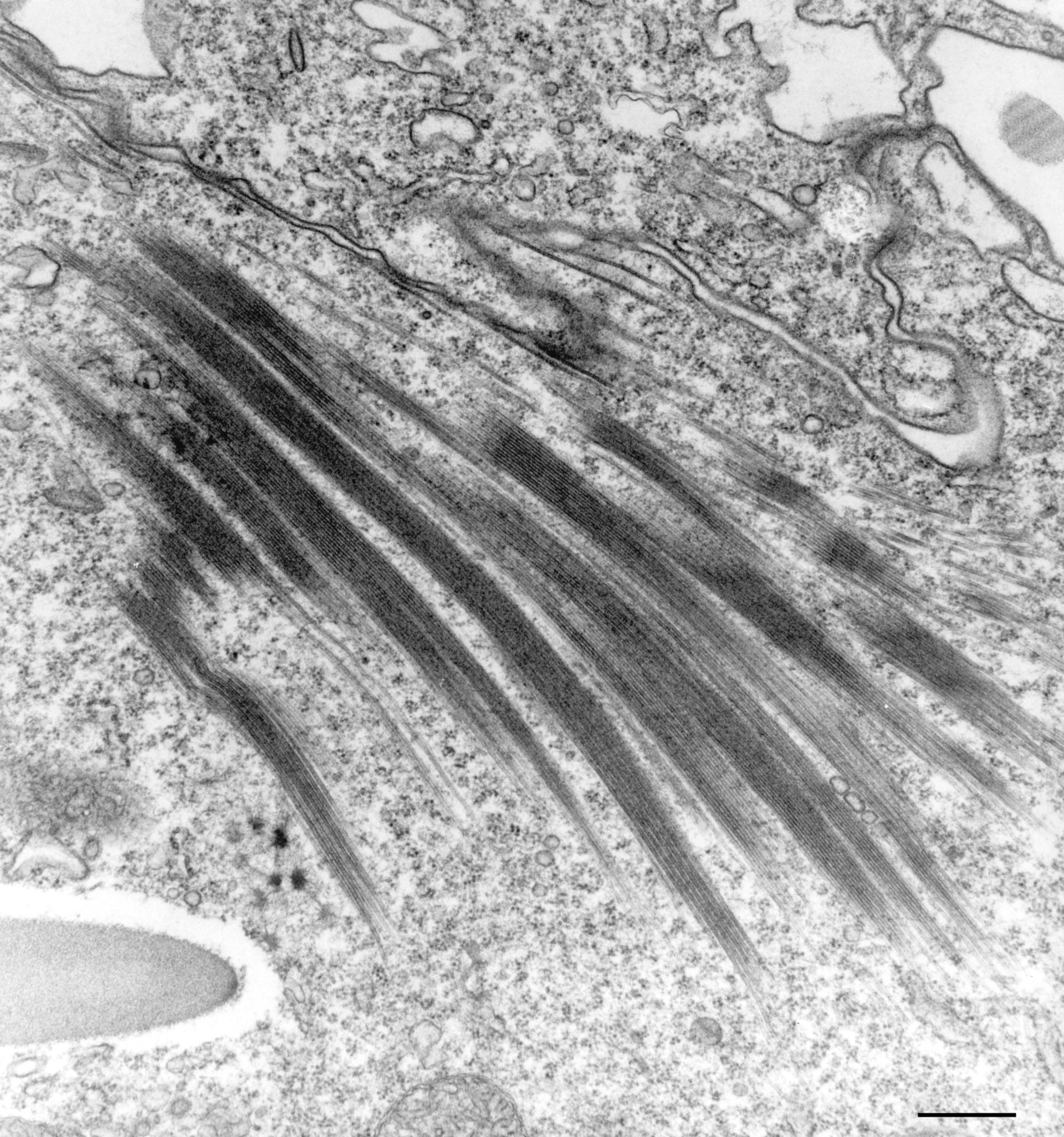 Paramecium multimicronucleatum (Food vacuole) - CIL:36698