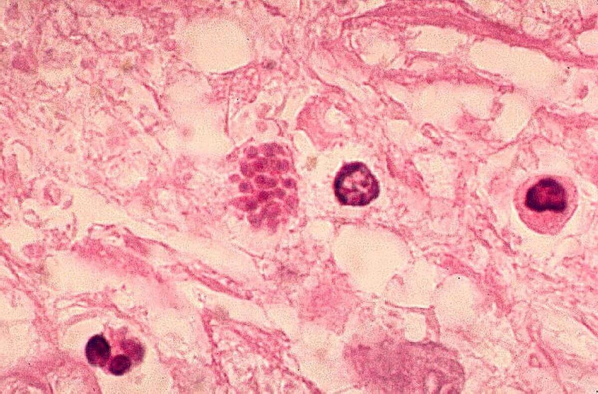 Tachyzoiten - Toxoplasma gondii