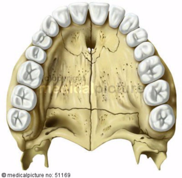 Adult Top Row of Teeth and Palate DocCheck