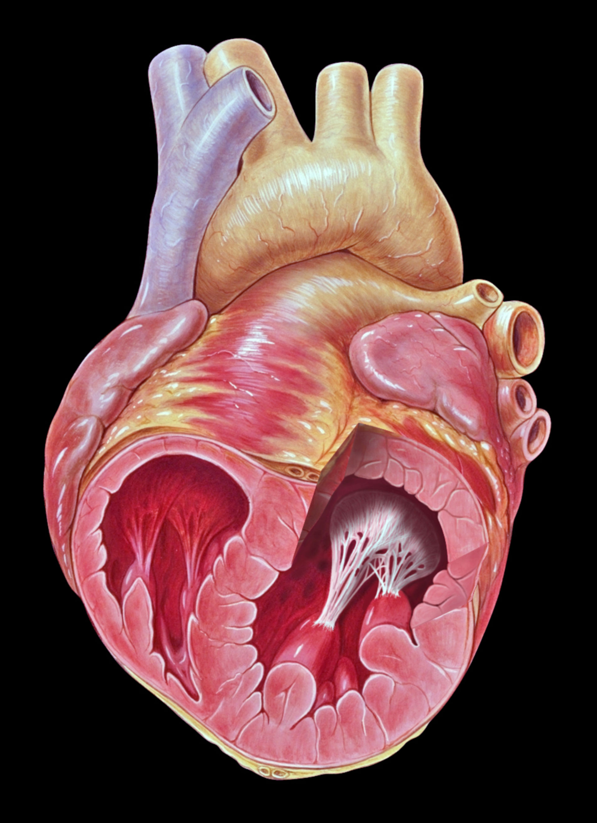 Herz mit Papillarmuskeln