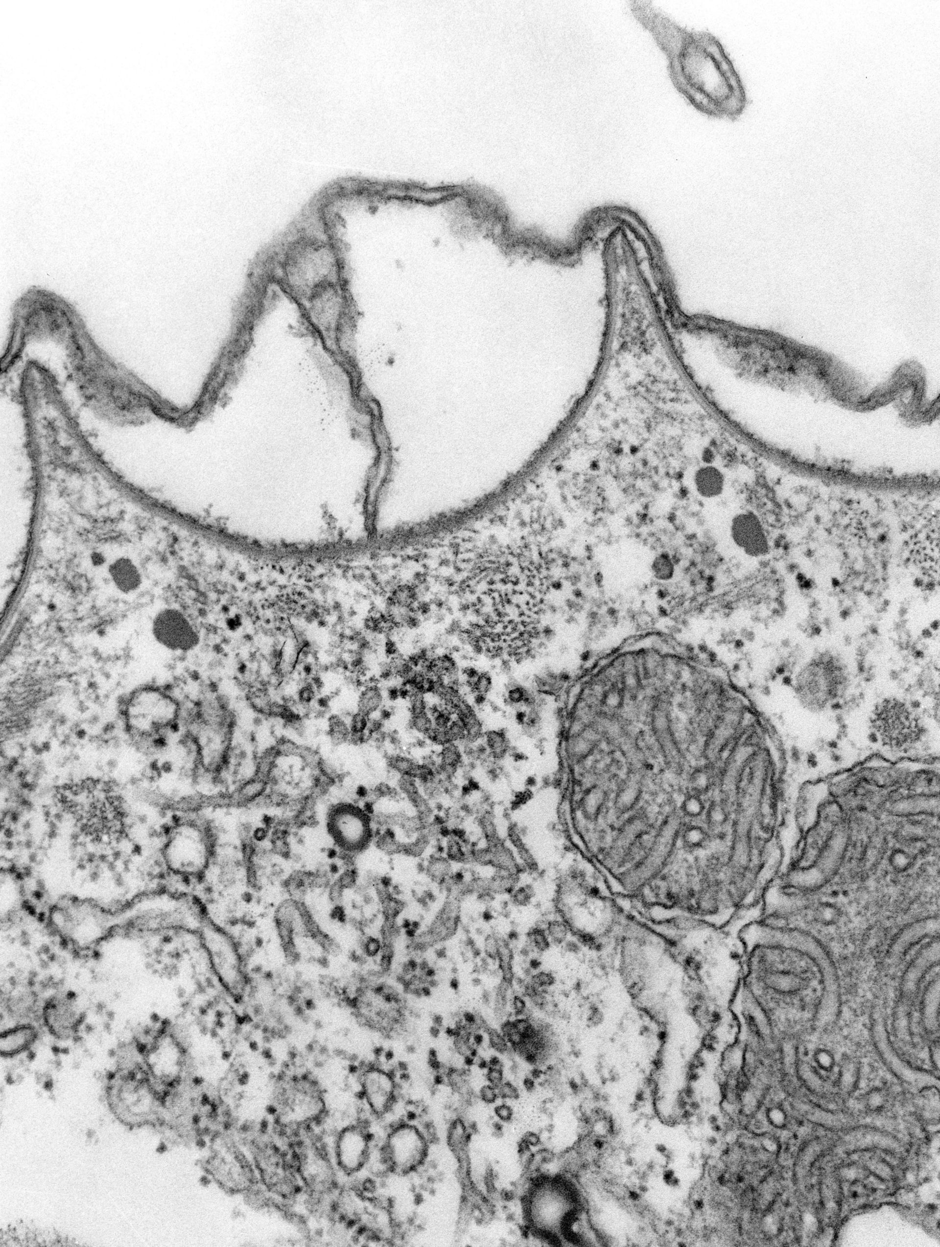 Paramecium multimicronucleatum (Cell cortex) - CIL:39309