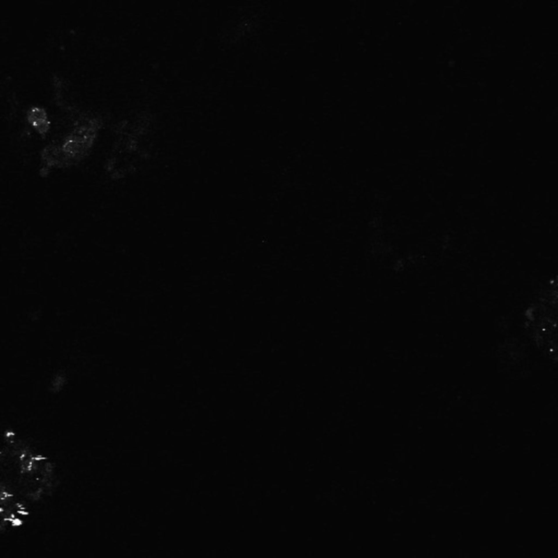 Xenopus laevis (Neuronal cell body) - CIL:36972