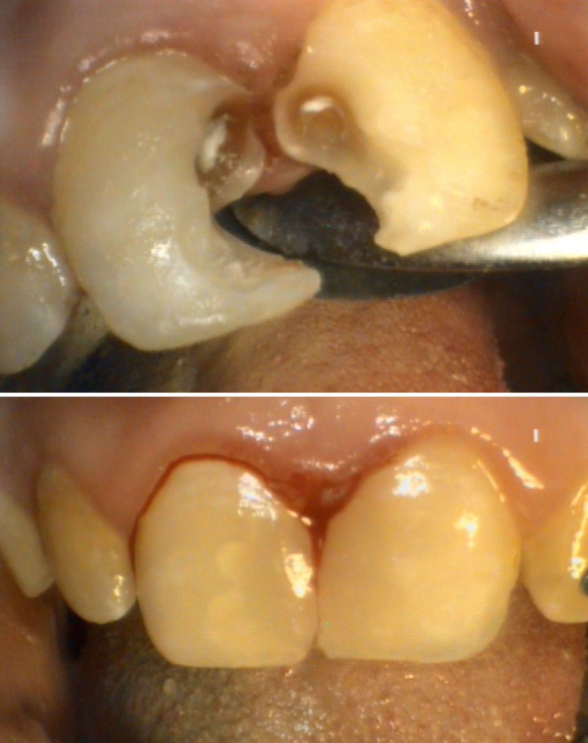 Zahnsanierung II