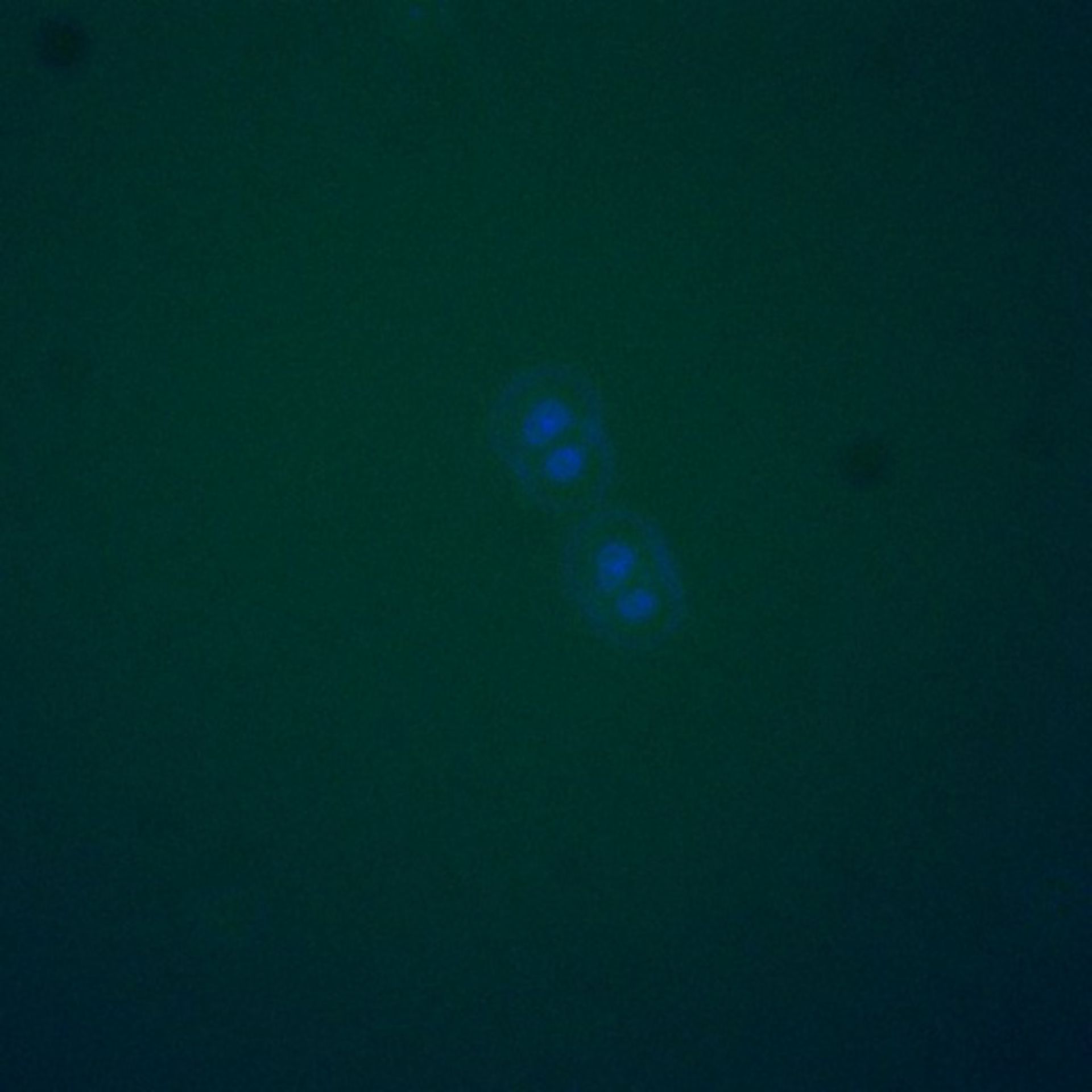 Saccharomyces cerevisiae (BUB2 protein) - CIL:39546