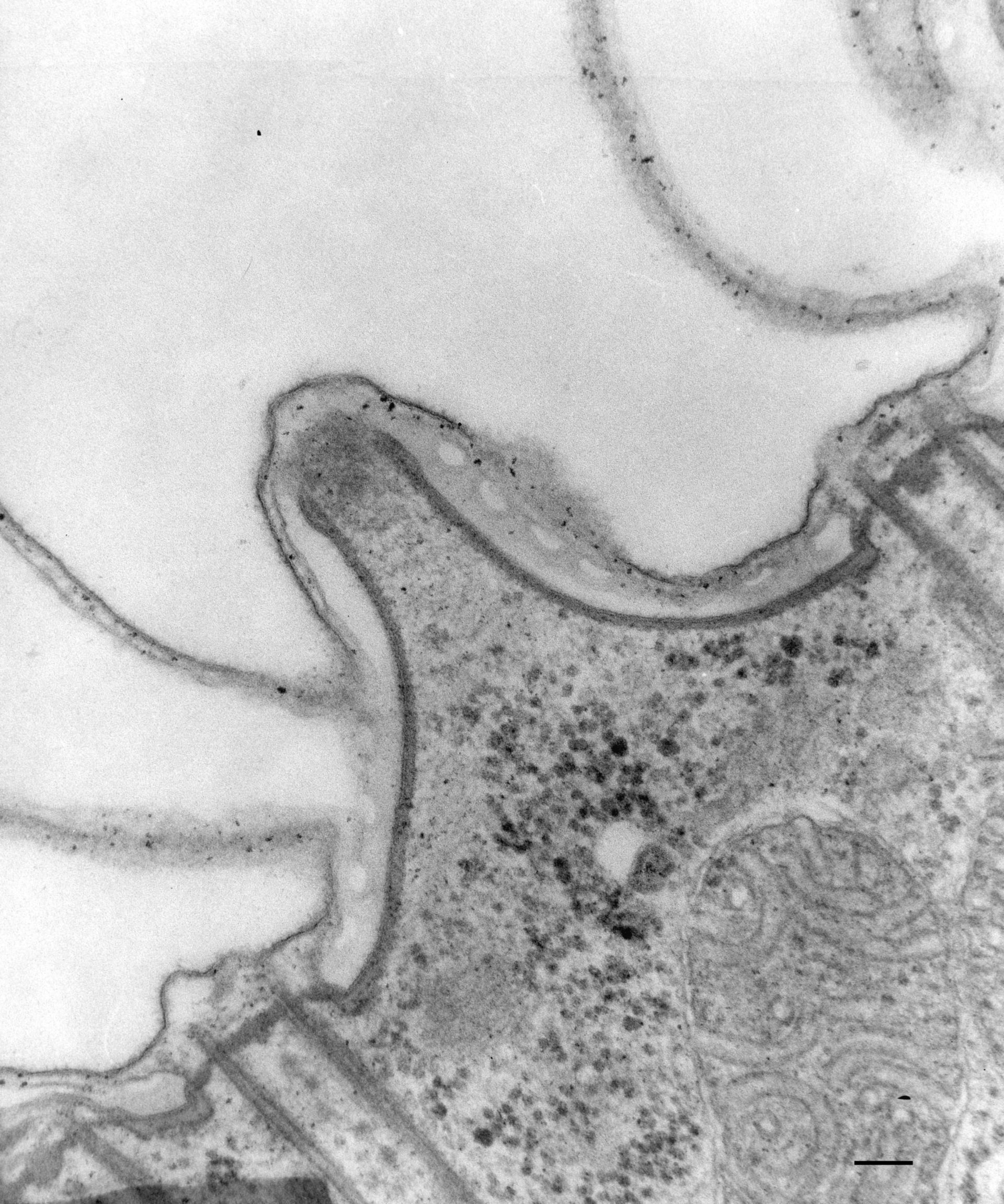 Paramecium caudatum (Cell cortex) - CIL:36761