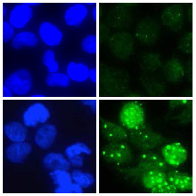 Behandelt man Krebszellen mit RITA (untere Bildreihe), so führt dies zur Beschädigung der DNA (angezeigt durch grüne Färbung), sofern der Reparaturmechanismus der betroffenen Zellen versagt. Die blaue Färbung markiert die Zellkerne. © Philipps-Universität Marburg