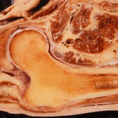 Hüftgelenk - DocCheck Flexikon