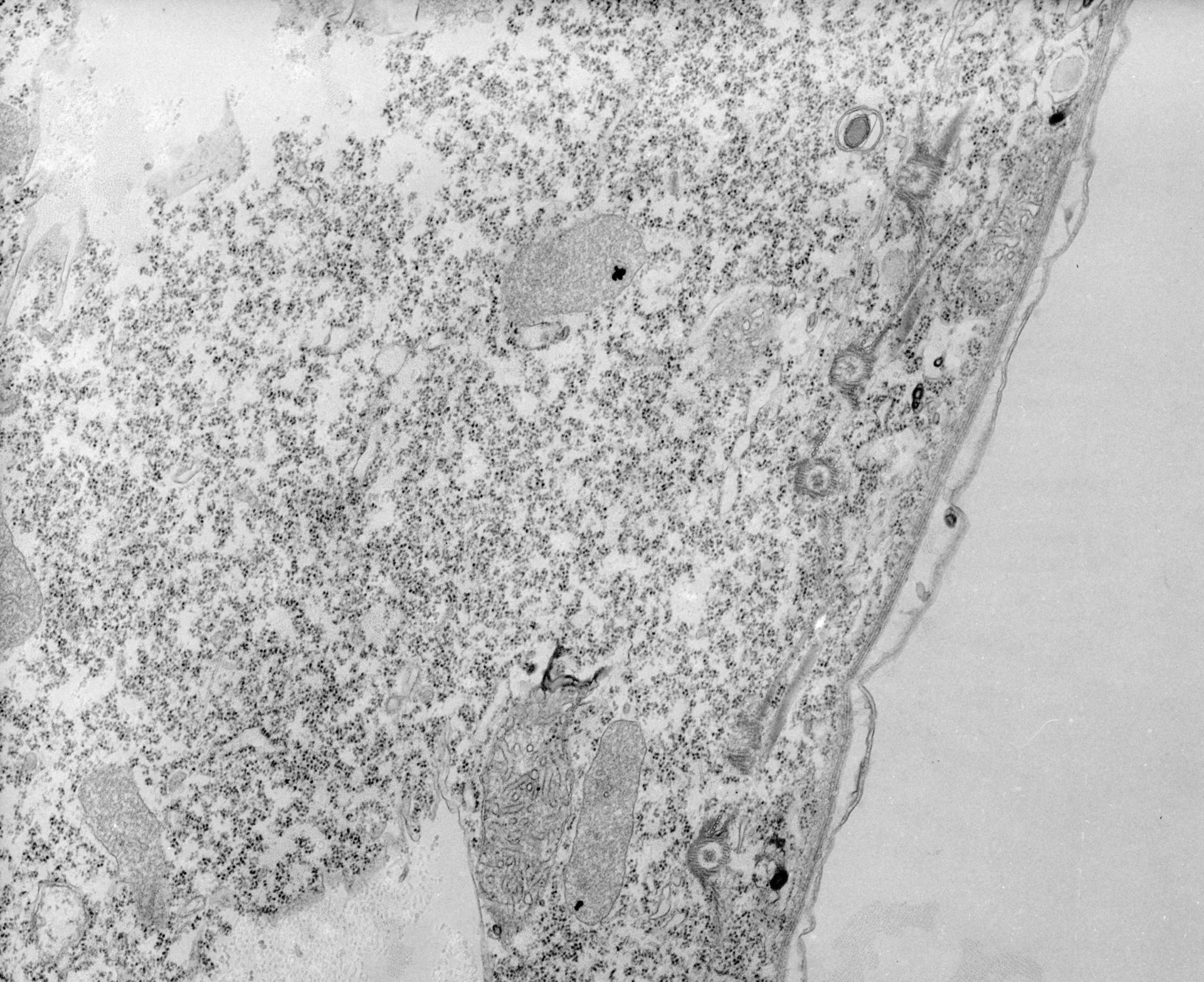 Tetrahymena pyriformis (Fibril) - CIL:39798