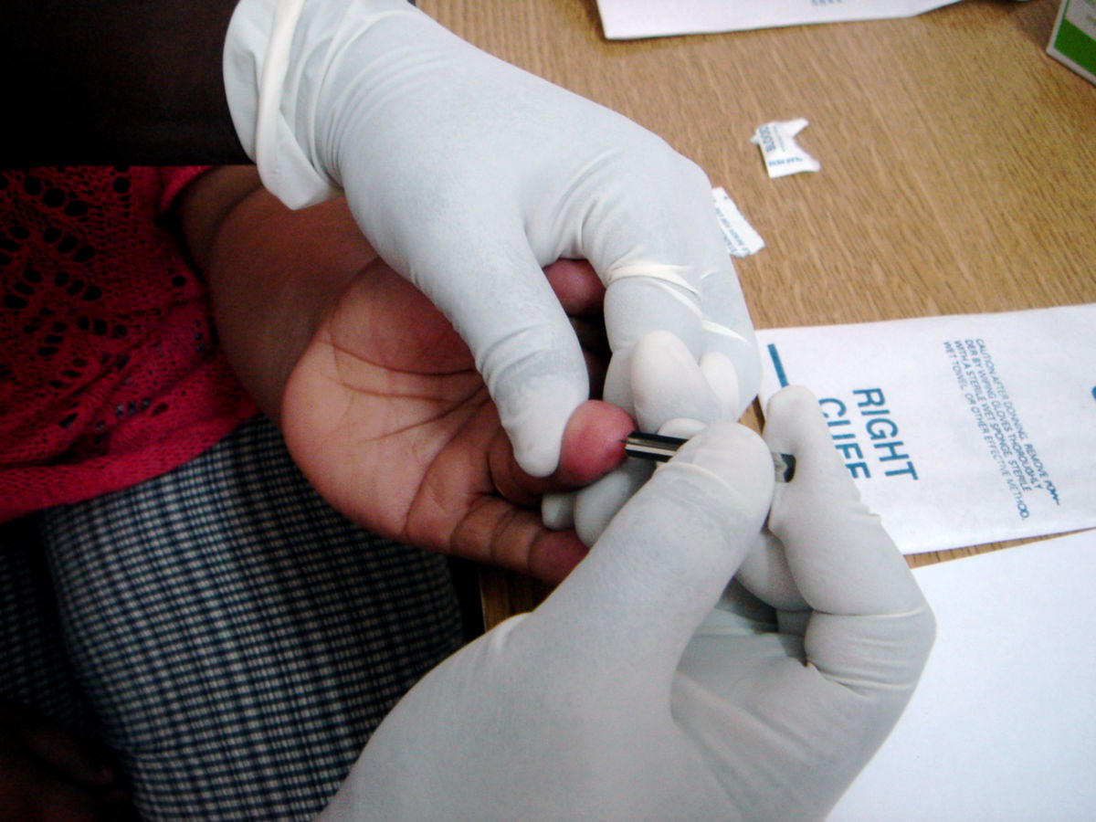 HIV-Test
